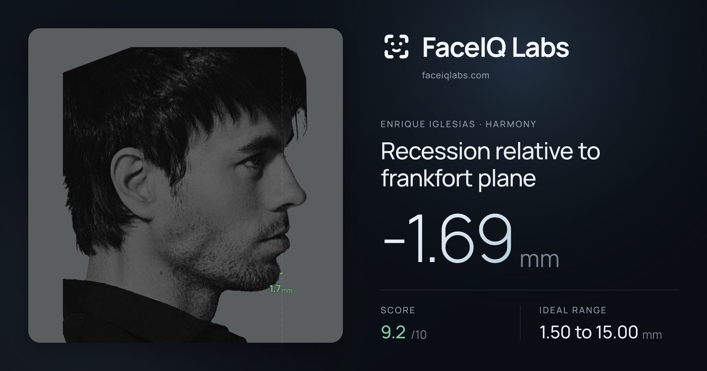 Enrique Iglesias Recession relative to frankfort plane: -1.69mm, drawn on the photo