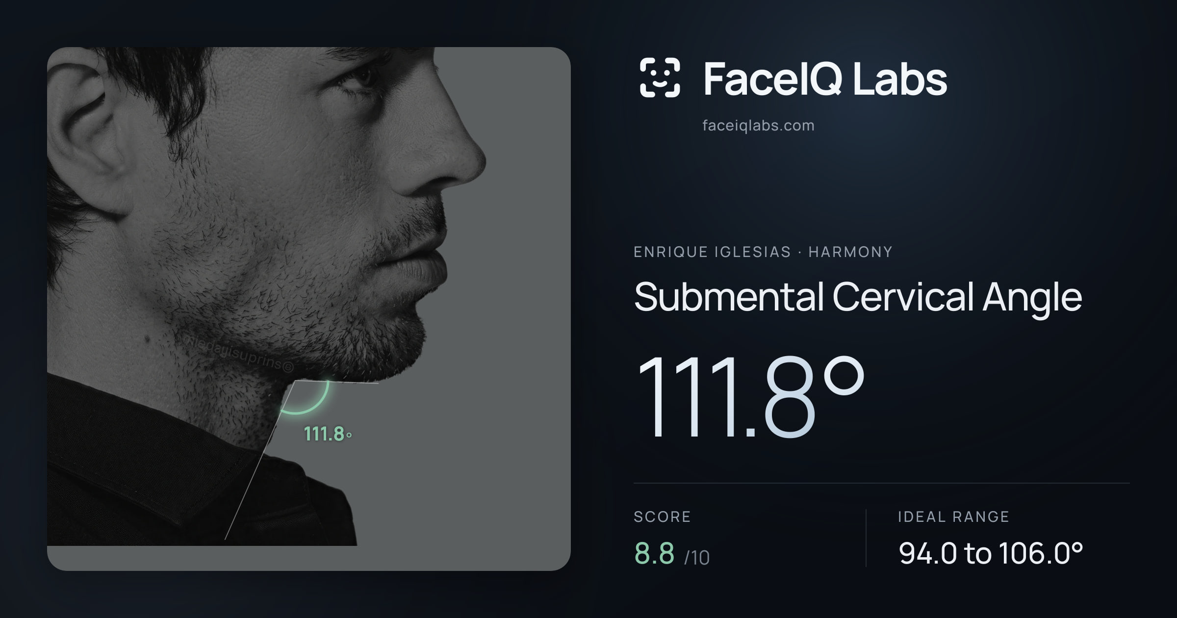 Enrique Iglesias Submental Cervical Angle: 111.8°, drawn on the photo