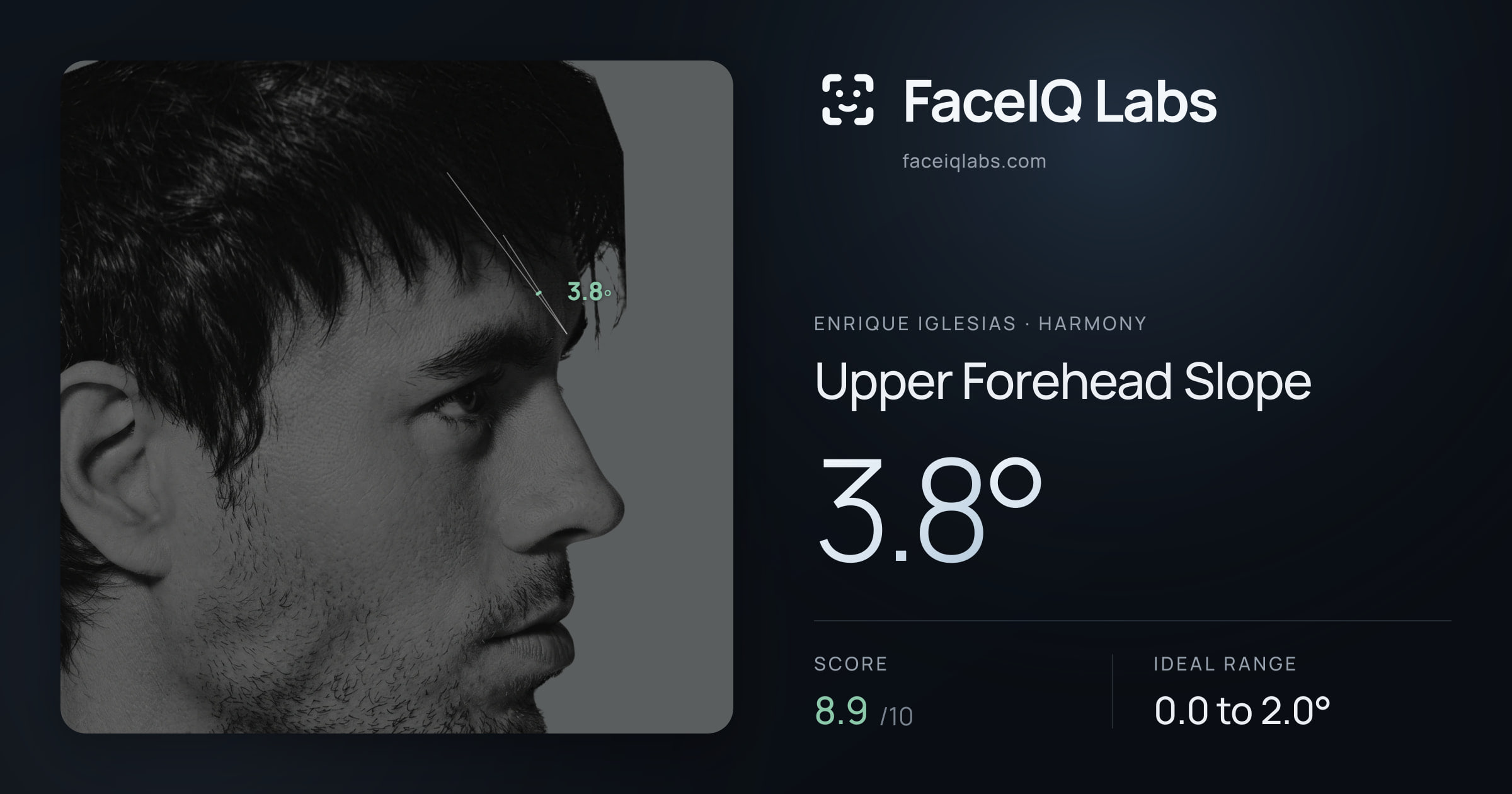 Enrique Iglesias Upper Forehead Slope: 3.8°, drawn on the photo