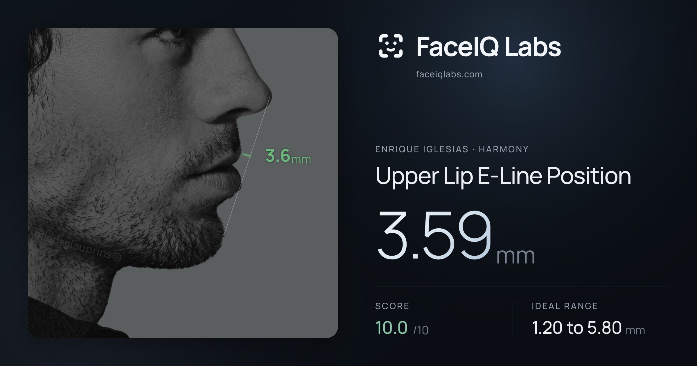 Enrique Iglesias Upper Lip E-Line Position: 3.59mm, drawn on the photo