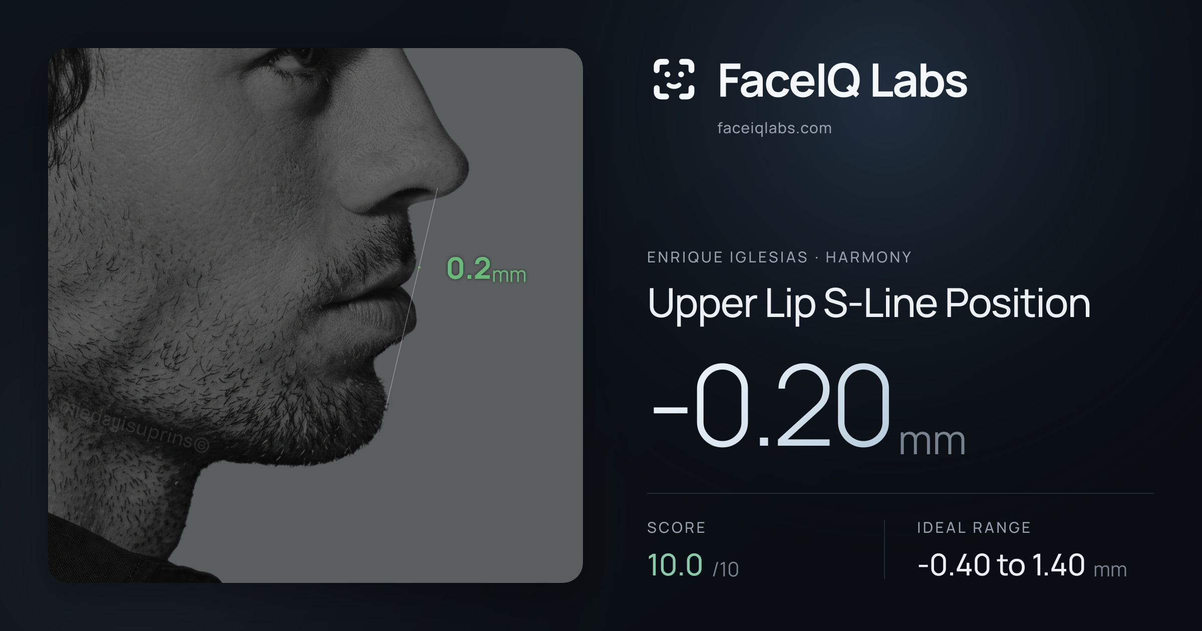 Enrique Iglesias Upper Lip S-Line Position: -0.20mm, drawn on the photo