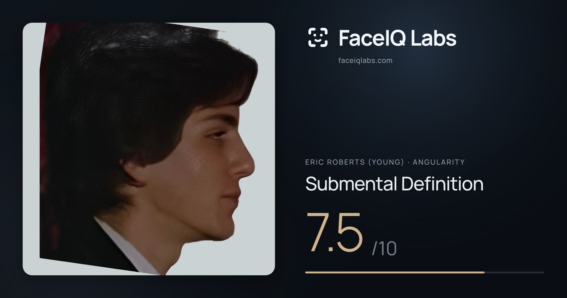 Eric Roberts (Young) Submental Definition: 7.5/10, drawn on the photo