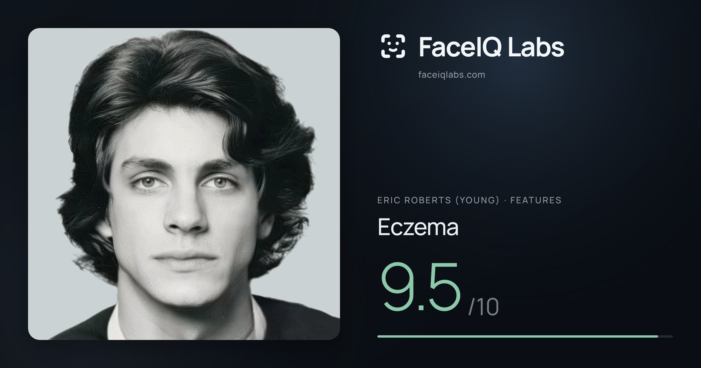Eric Roberts (Young) Eczema: 9.5/10, drawn on the photo