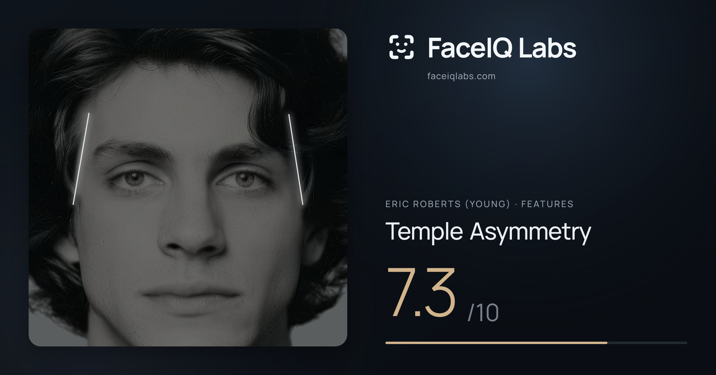 Eric Roberts (Young) Temple Asymmetry: 7.3/10, drawn on the photo