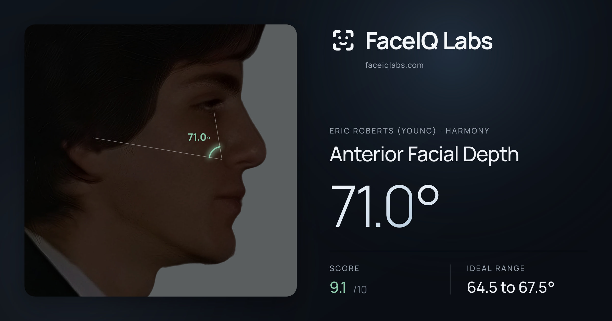 Eric Roberts (Young) Anterior Facial Depth: 71.0°, drawn on the photo
