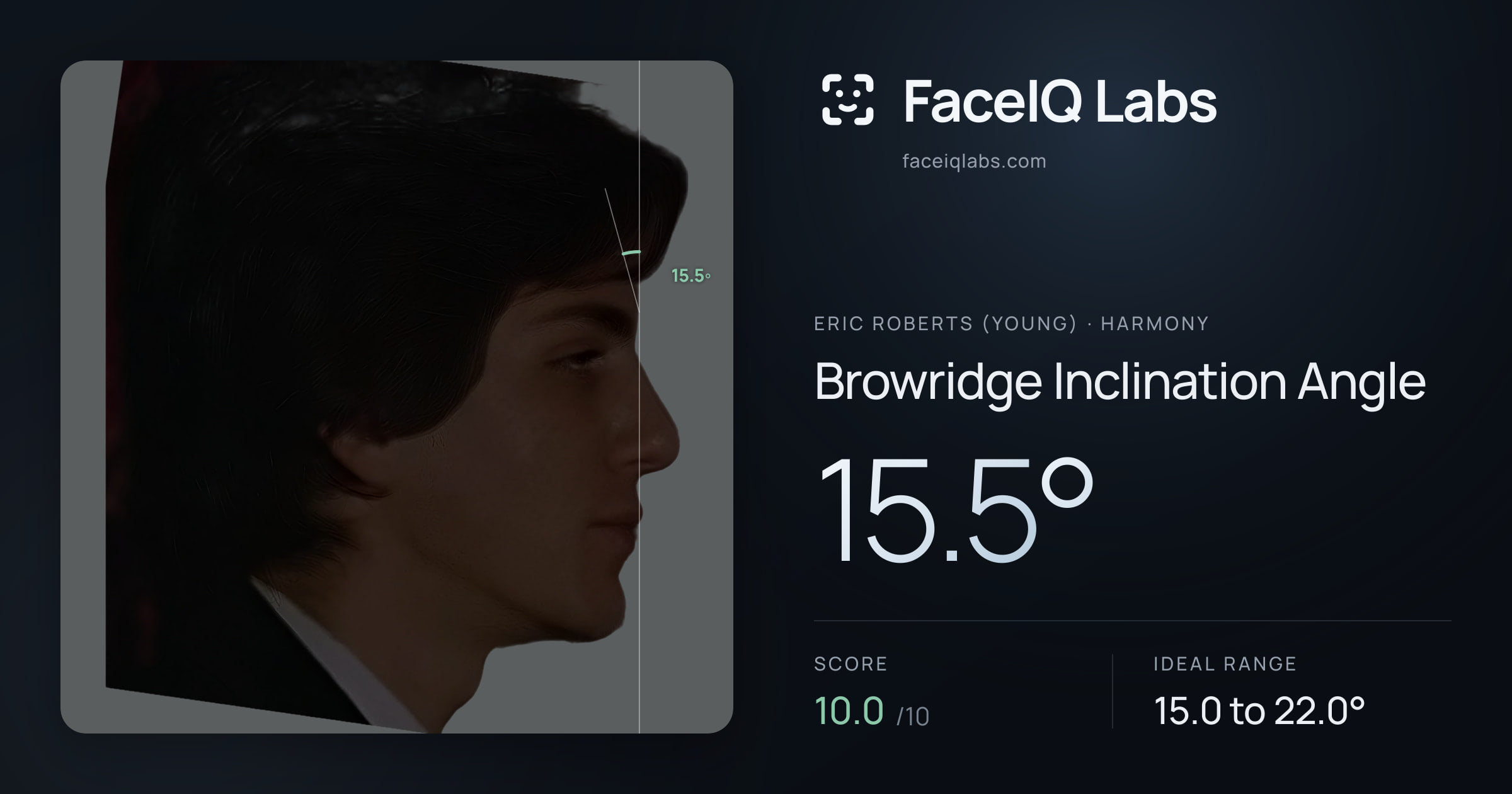 Eric Roberts (Young) Browridge Inclination Angle: 15.5°, drawn on the photo