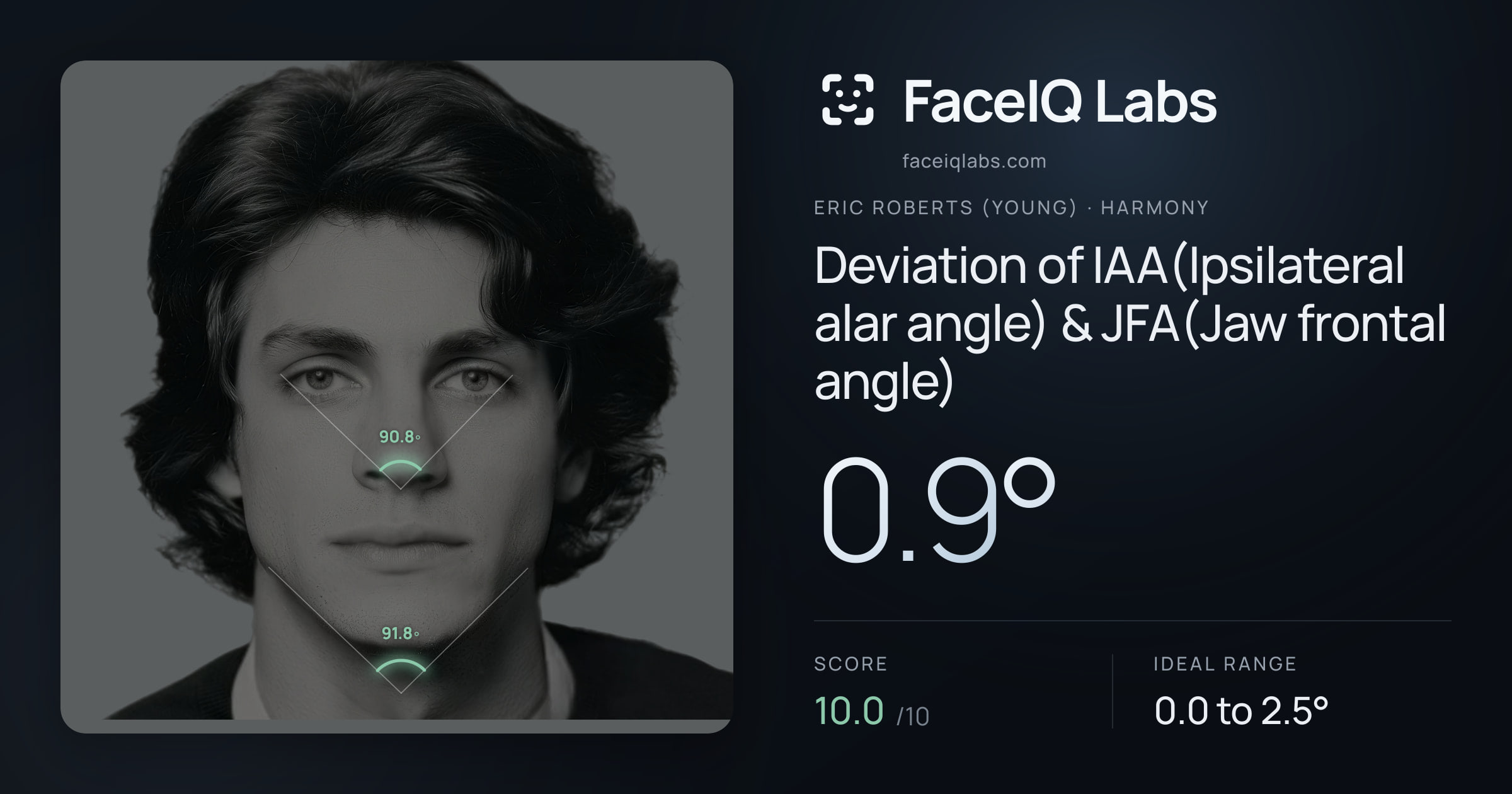 Eric Roberts (Young) Deviation of IAA(Ipsilateral alar angle) & JFA(Jaw frontal angle): 0.9°, drawn on the photo