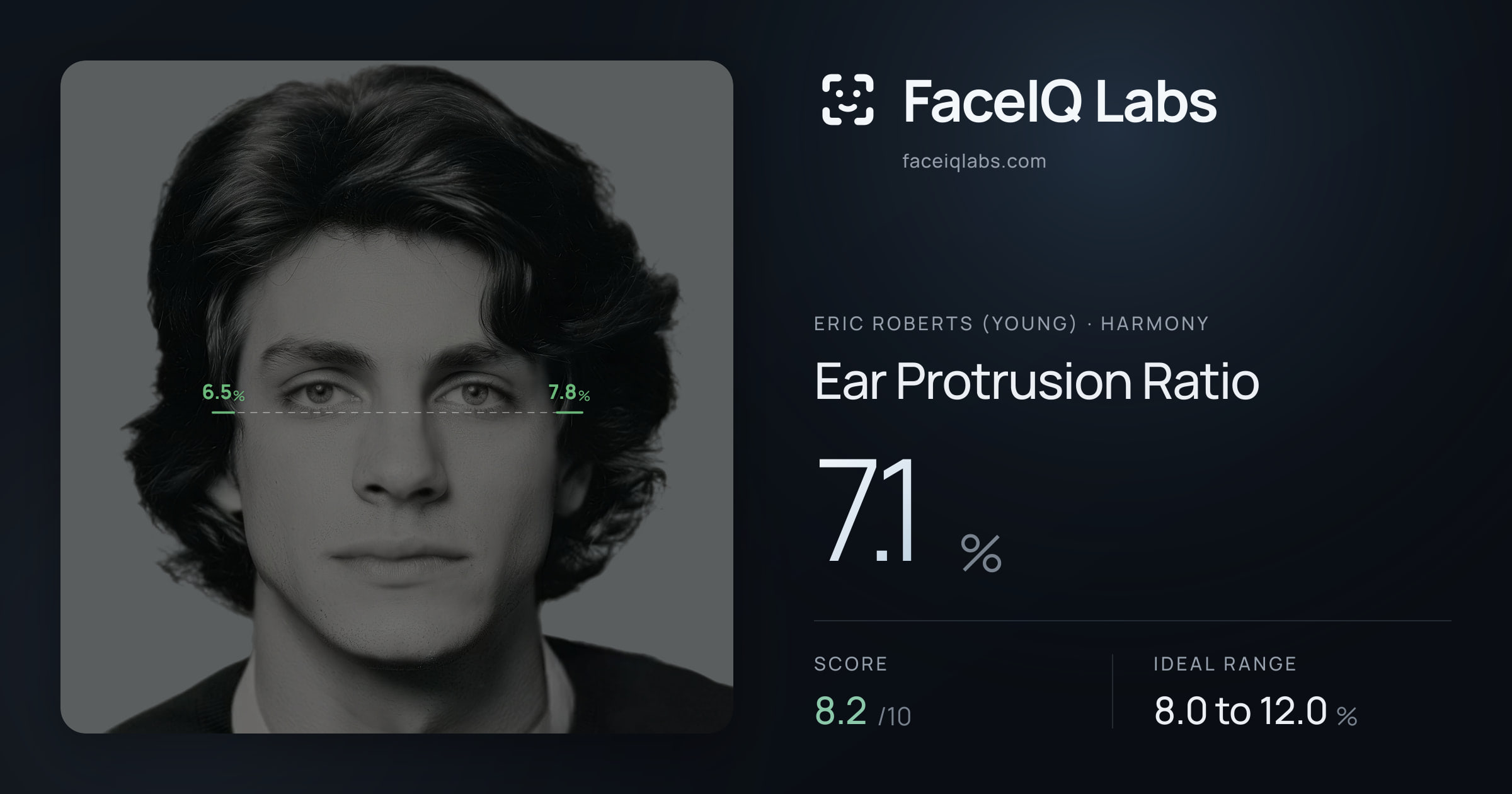 Eric Roberts (Young) Ear Protrusion Ratio: 7.1%, drawn on the photo