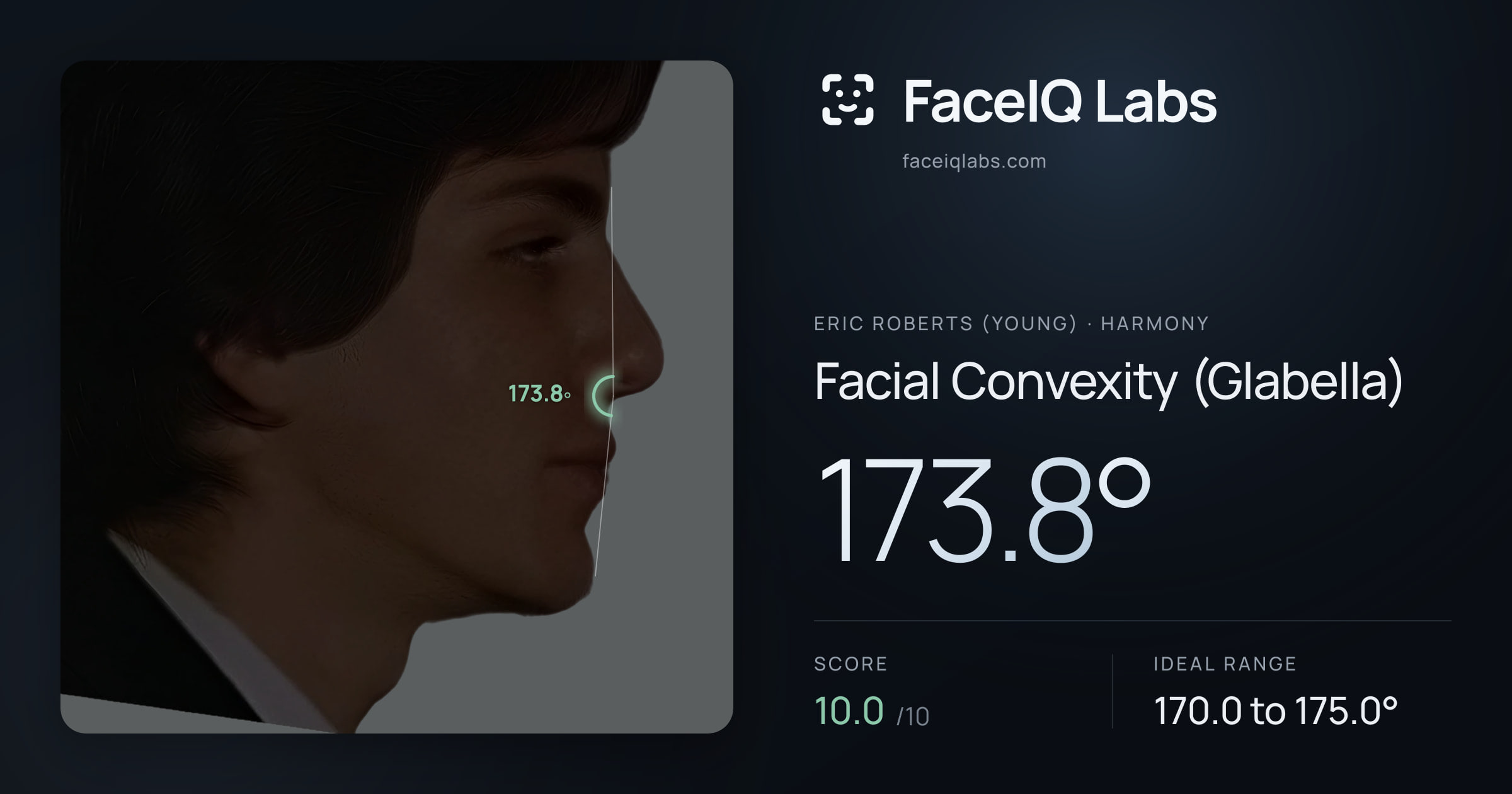 Eric Roberts (Young) Facial Convexity (Glabella): 173.8°, drawn on the photo