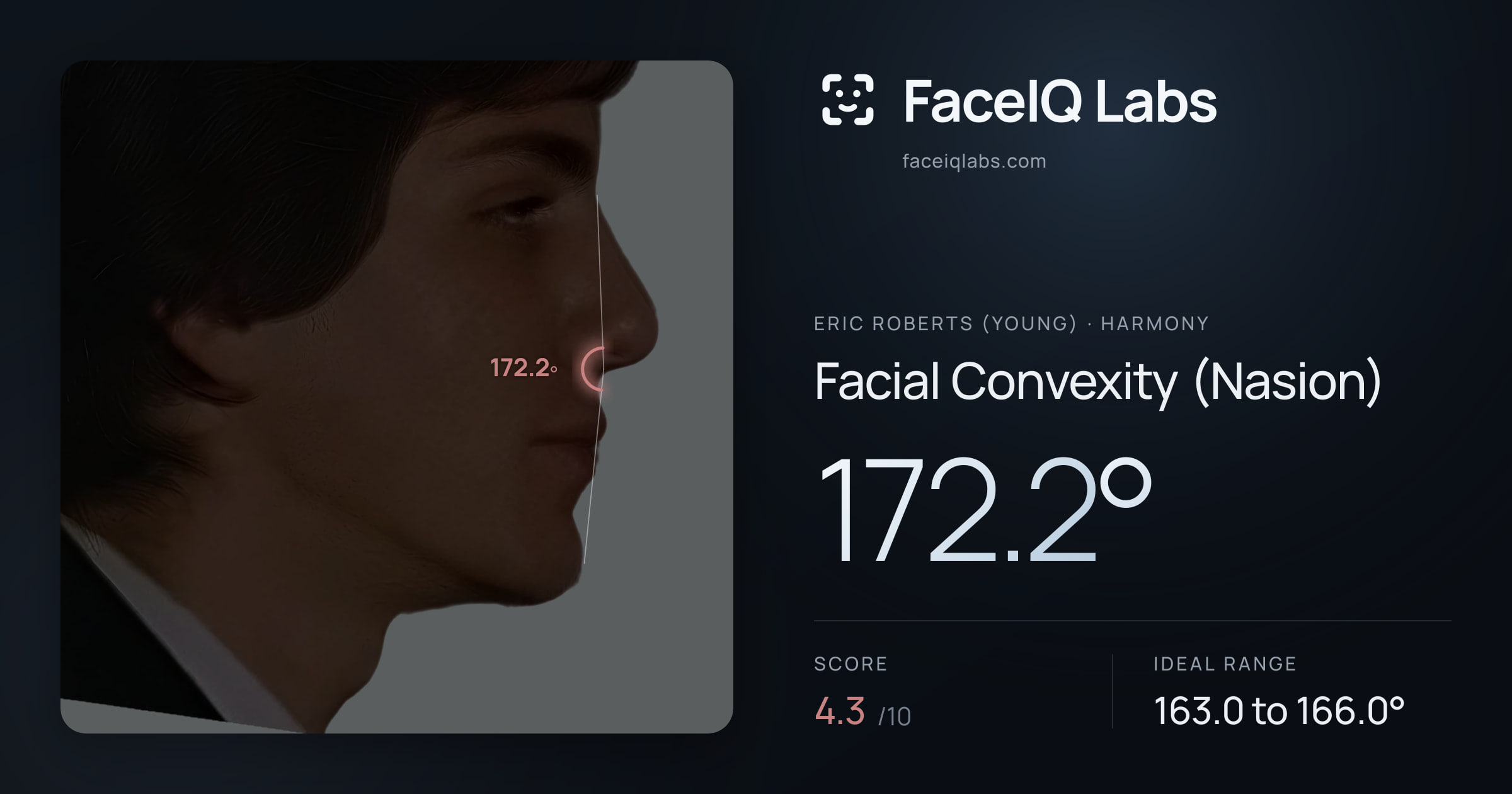 Eric Roberts (Young) Facial Convexity (Nasion): 172.2°, drawn on the photo