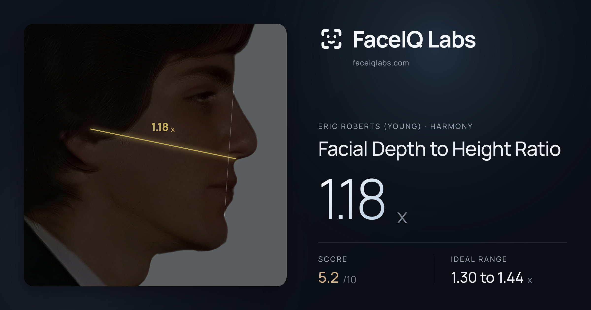 Eric Roberts (Young) Facial Depth to Height Ratio: 1.18x, drawn on the photo