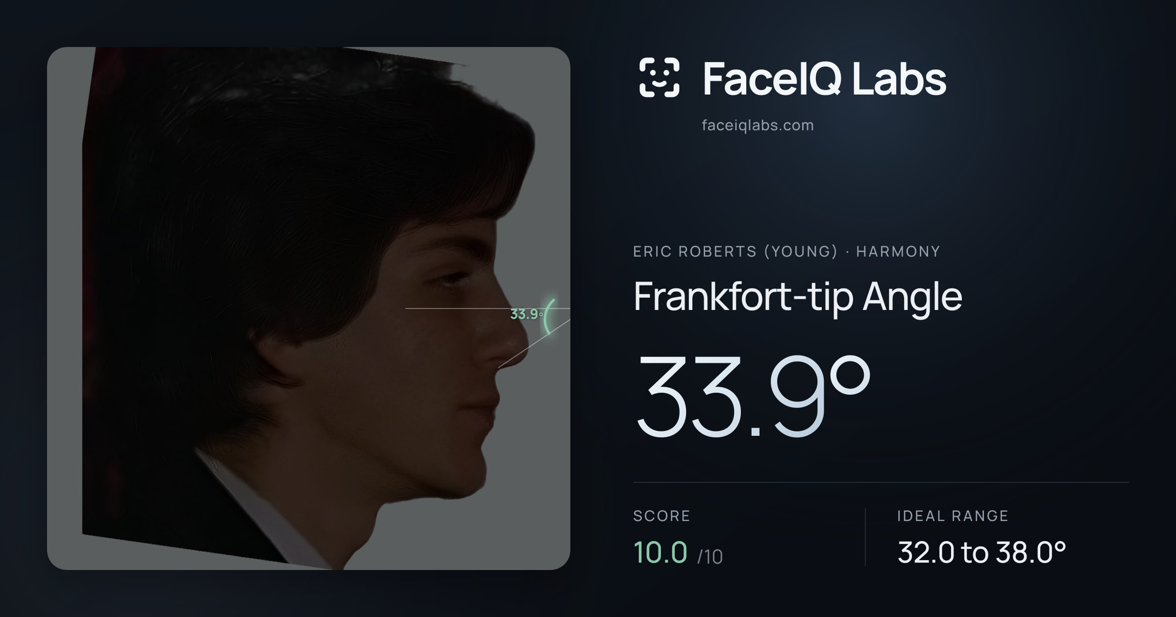 Eric Roberts (Young) Frankfort-tip Angle: 33.9°, drawn on the photo