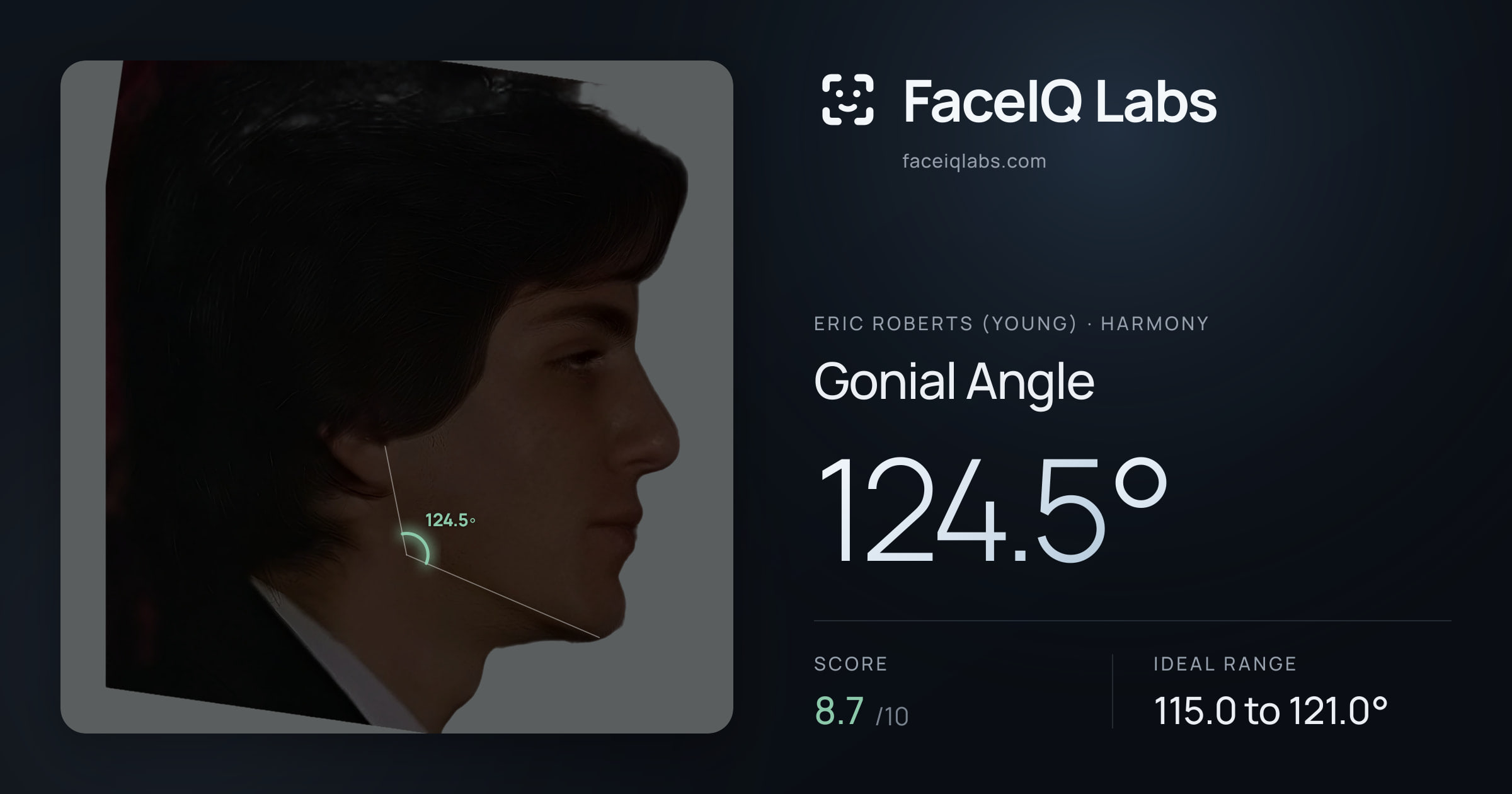 Eric Roberts (Young) Gonial Angle: 124.5°, drawn on the photo