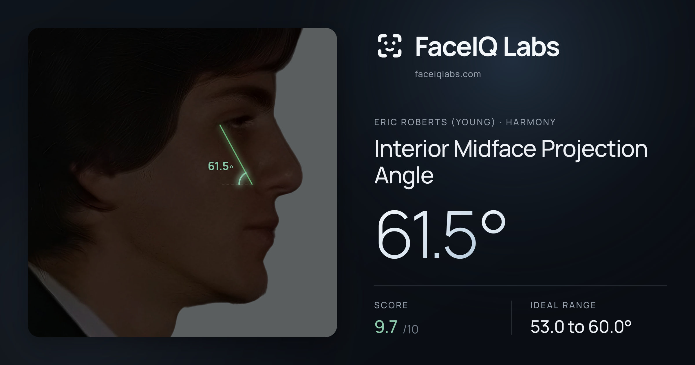Eric Roberts (Young) Interior Midface Projection Angle: 61.5°, drawn on the photo