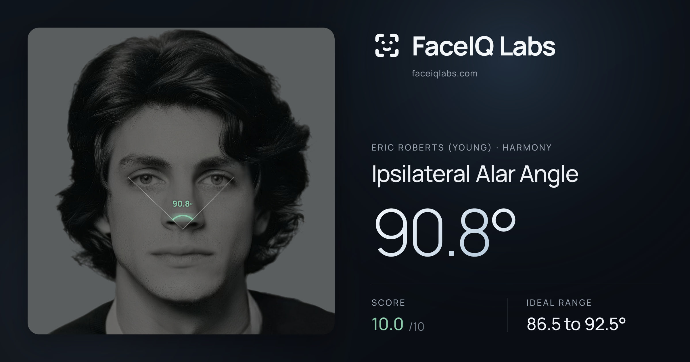 Eric Roberts (Young) Ipsilateral Alar Angle: 90.8°, drawn on the photo