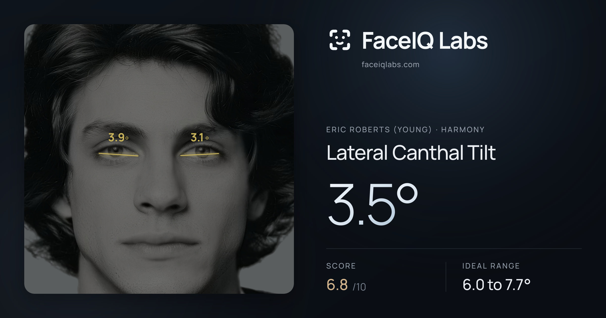 Eric Roberts (Young) Lateral Canthal Tilt: 3.5°, drawn on the photo