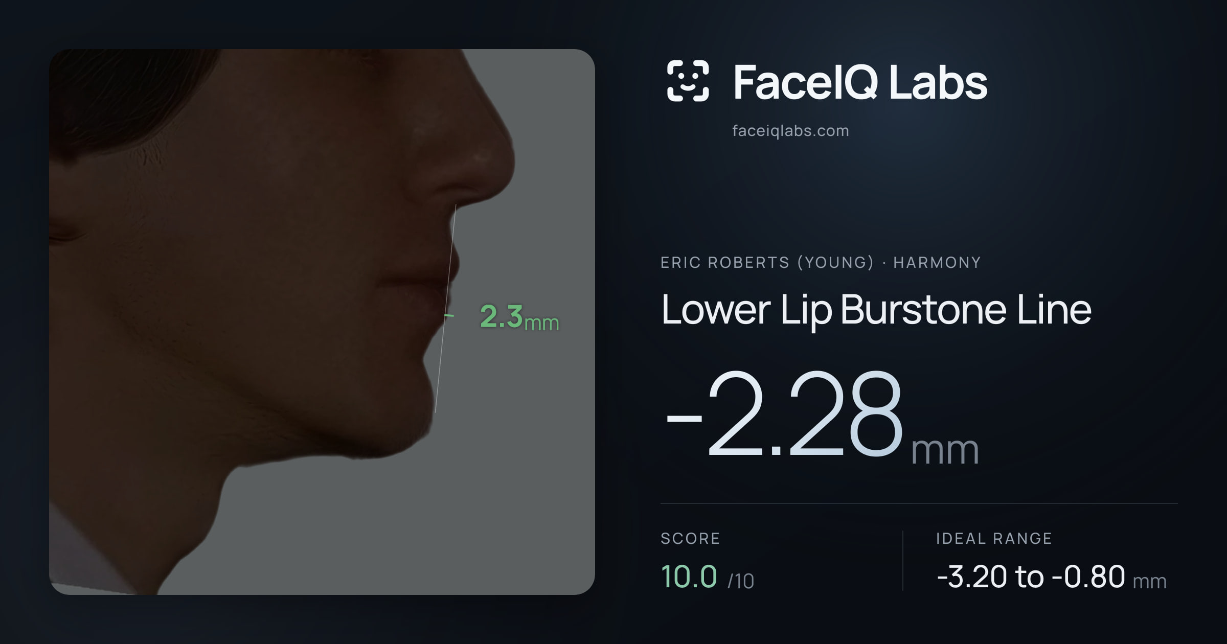 Eric Roberts (Young) Lower Lip Burstone Line: -2.28mm, drawn on the photo