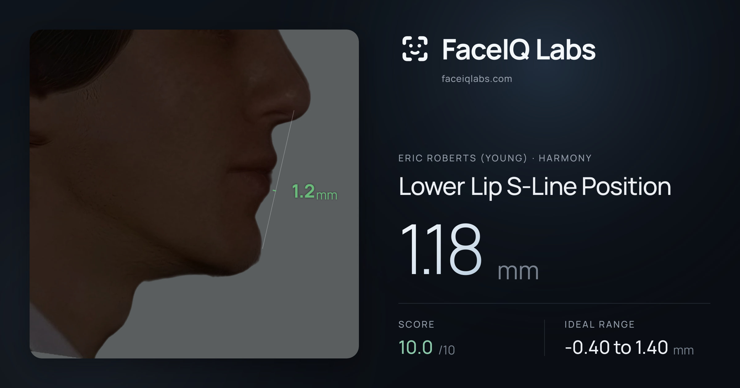 Eric Roberts (Young) Lower Lip S-Line Position: 1.18mm, drawn on the photo
