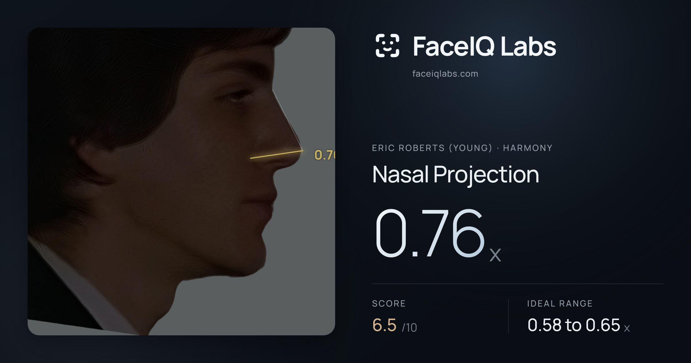Eric Roberts (Young) Nasal Projection: 0.76x, drawn on the photo
