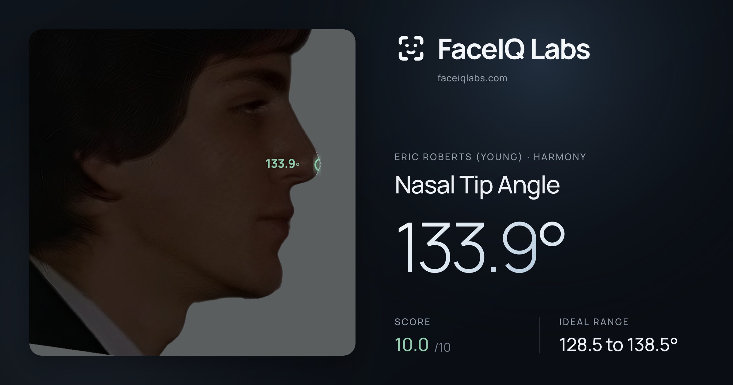 Eric Roberts (Young) Nasal Tip Angle: 133.9°, drawn on the photo