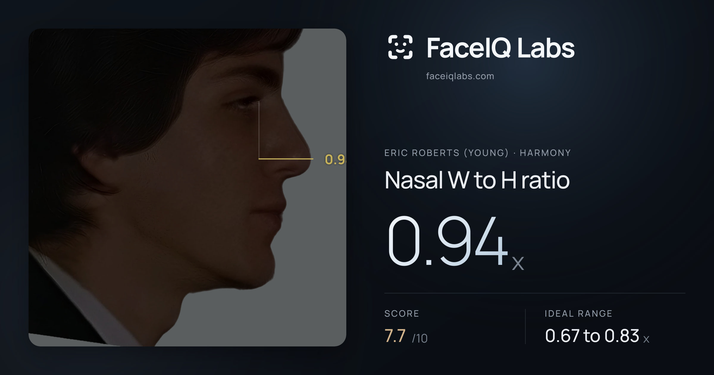 Eric Roberts (Young) Nasal W to H ratio: 0.94x, drawn on the photo