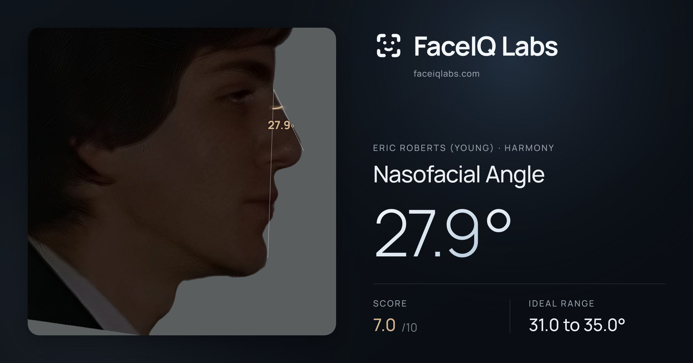 Eric Roberts (Young) Nasofacial Angle: 27.9°, drawn on the photo
