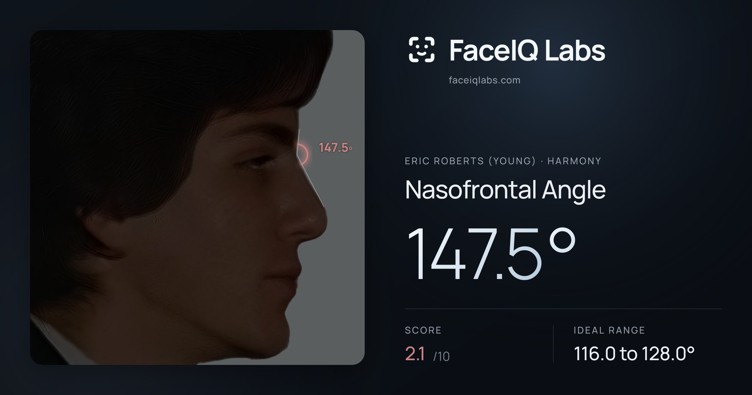 Eric Roberts (Young) Nasofrontal Angle: 147.5°, drawn on the photo