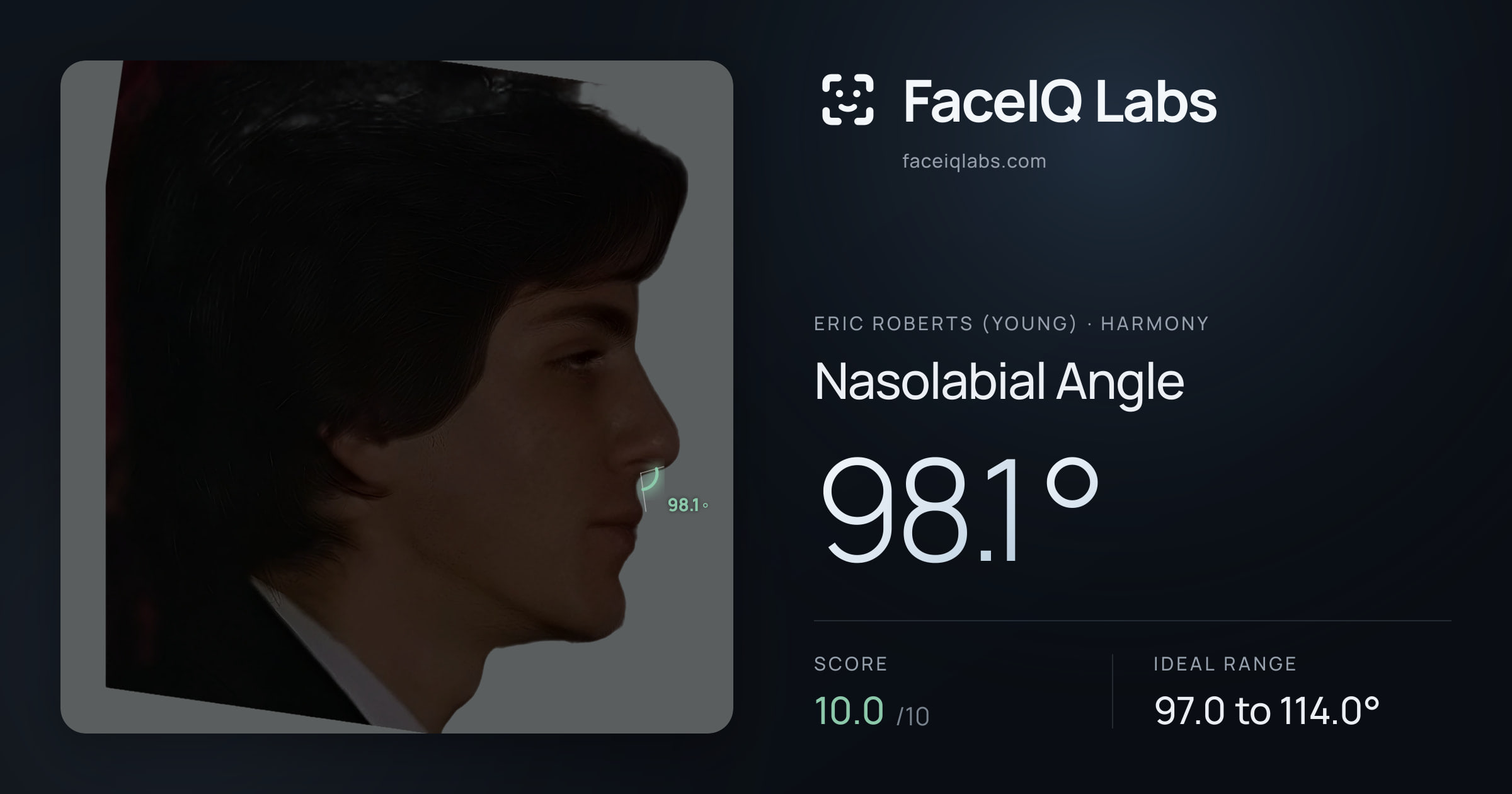 Eric Roberts (Young) Nasolabial Angle: 98.1°, drawn on the photo