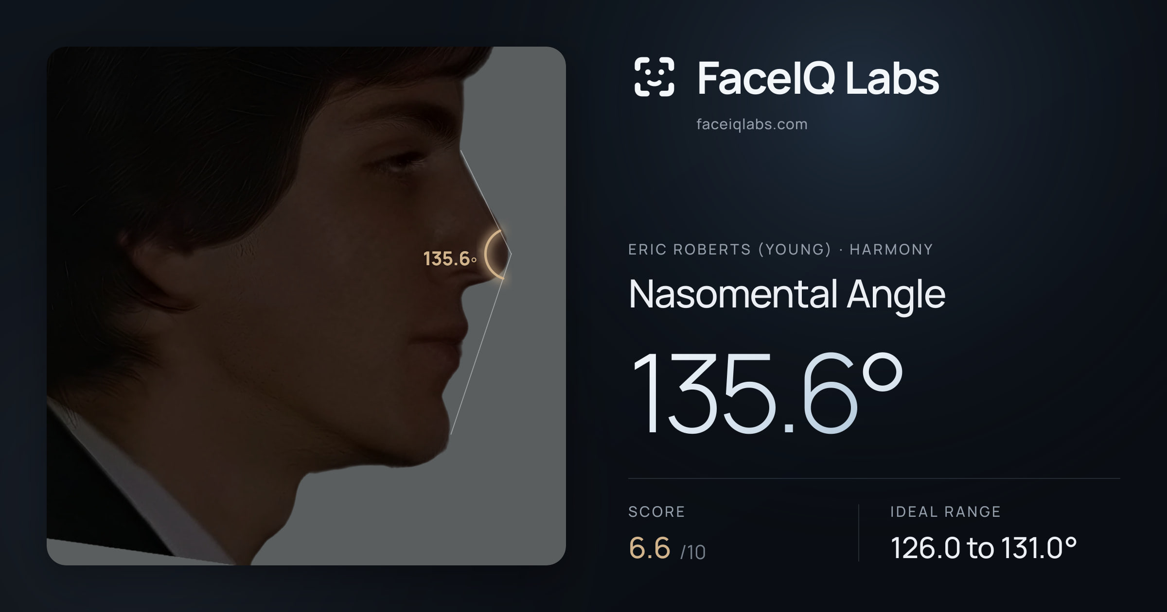 Eric Roberts (Young) Nasomental Angle: 135.6°, drawn on the photo