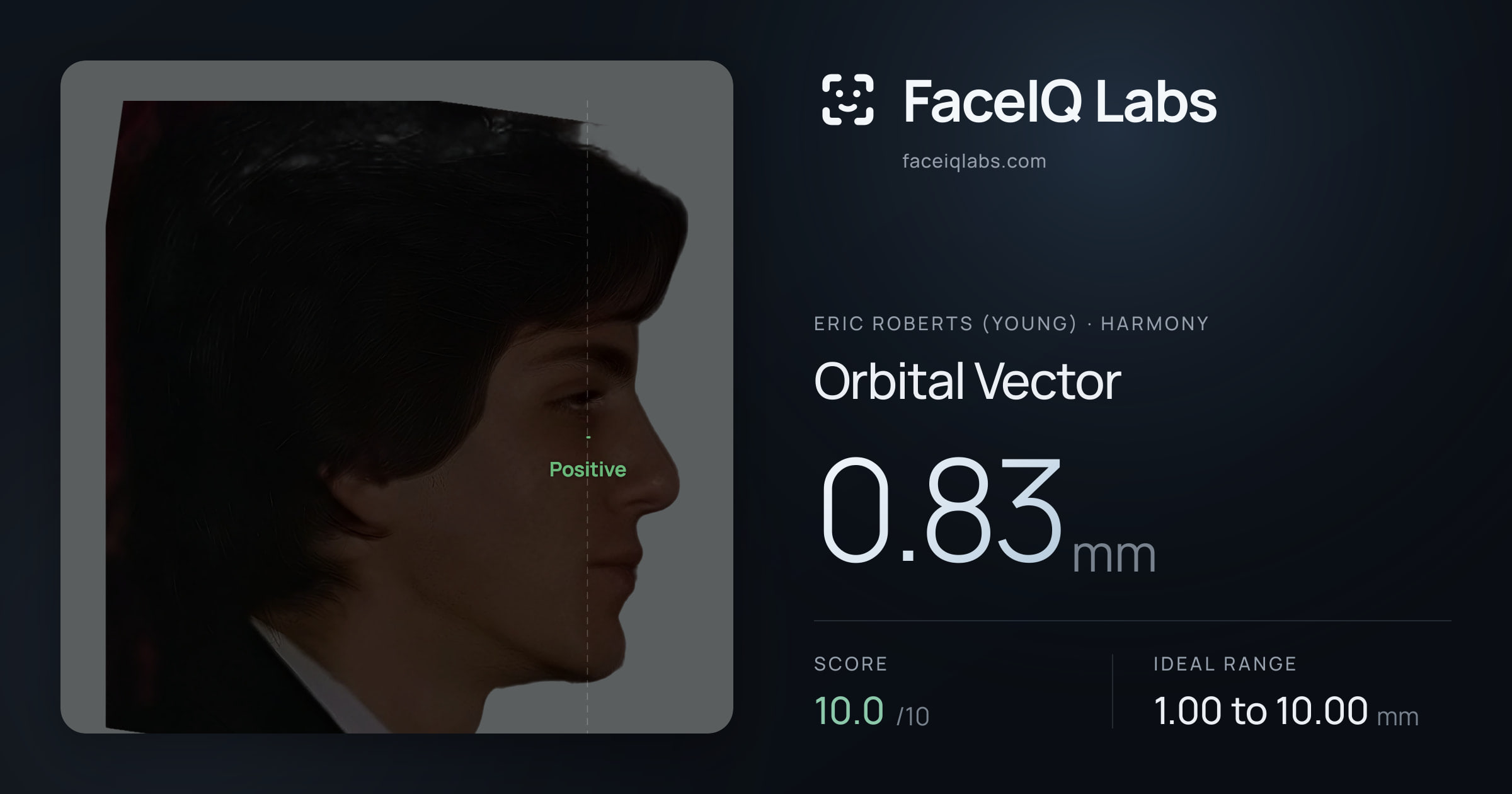 Eric Roberts (Young) Orbital Vector: 0.83mm, drawn on the photo