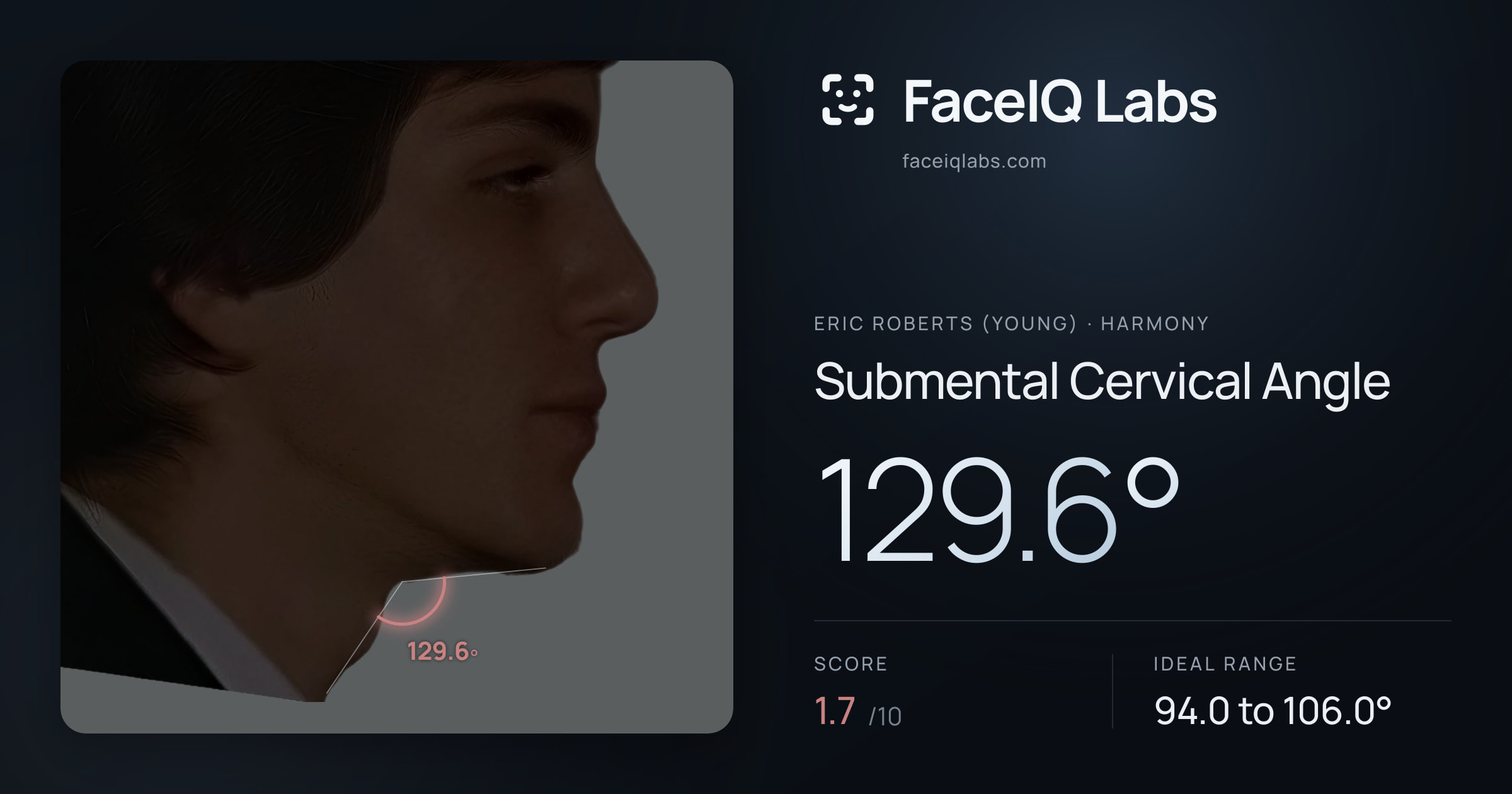 Eric Roberts (Young) Submental Cervical Angle: 129.6°, drawn on the photo