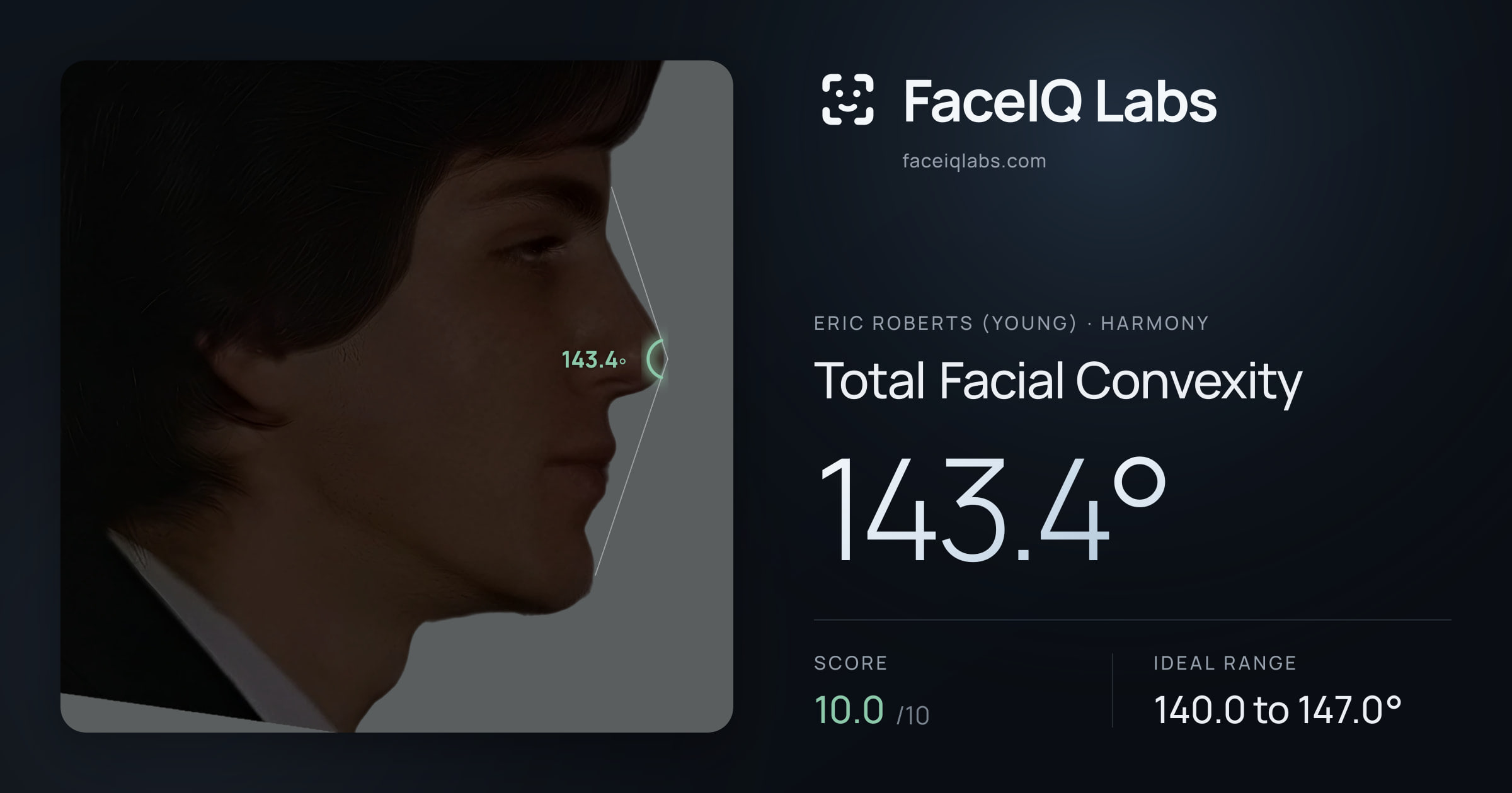 Eric Roberts (Young) Total Facial Convexity: 143.4°, drawn on the photo