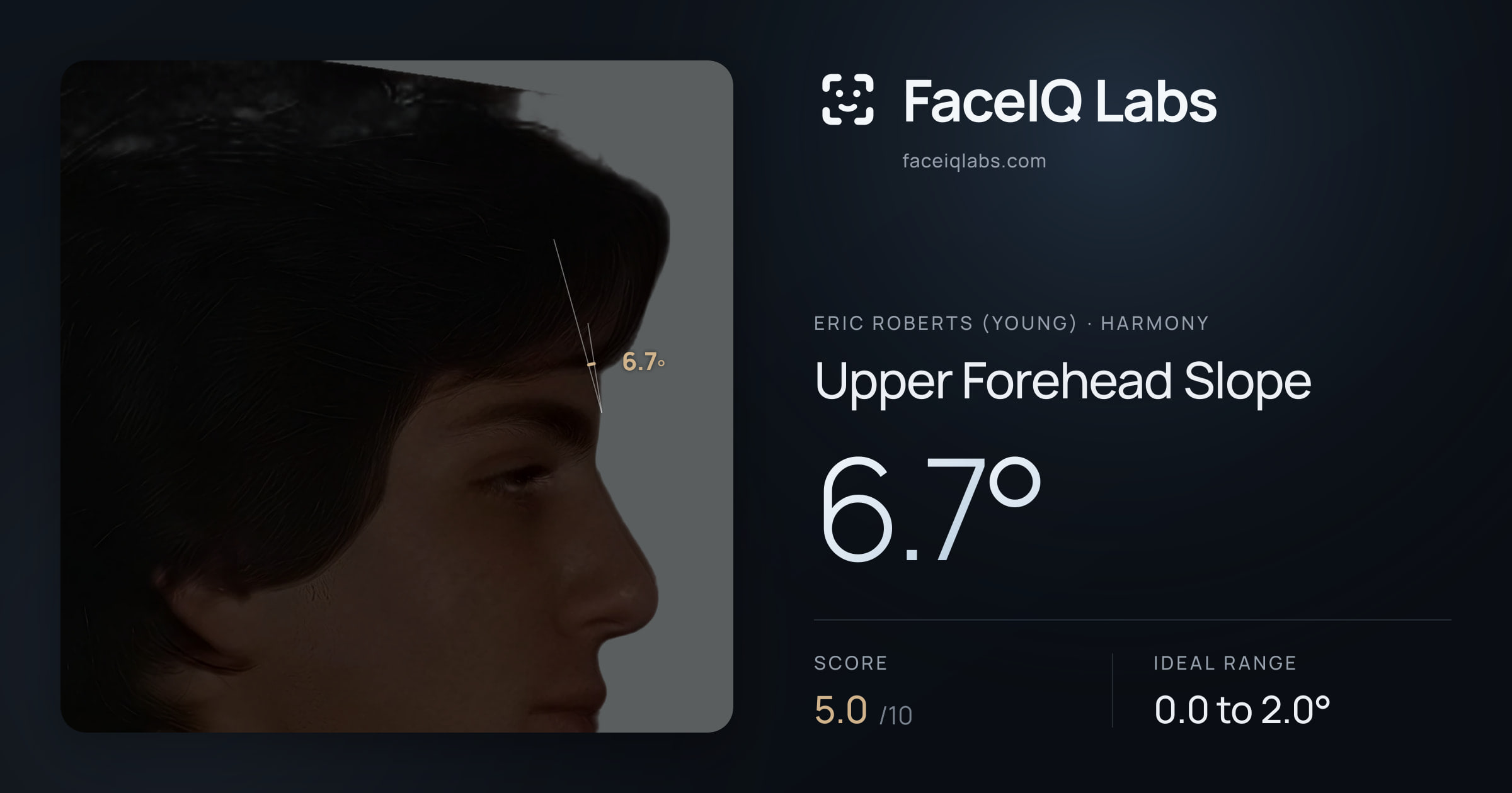 Eric Roberts (Young) Upper Forehead Slope: 6.7°, drawn on the photo