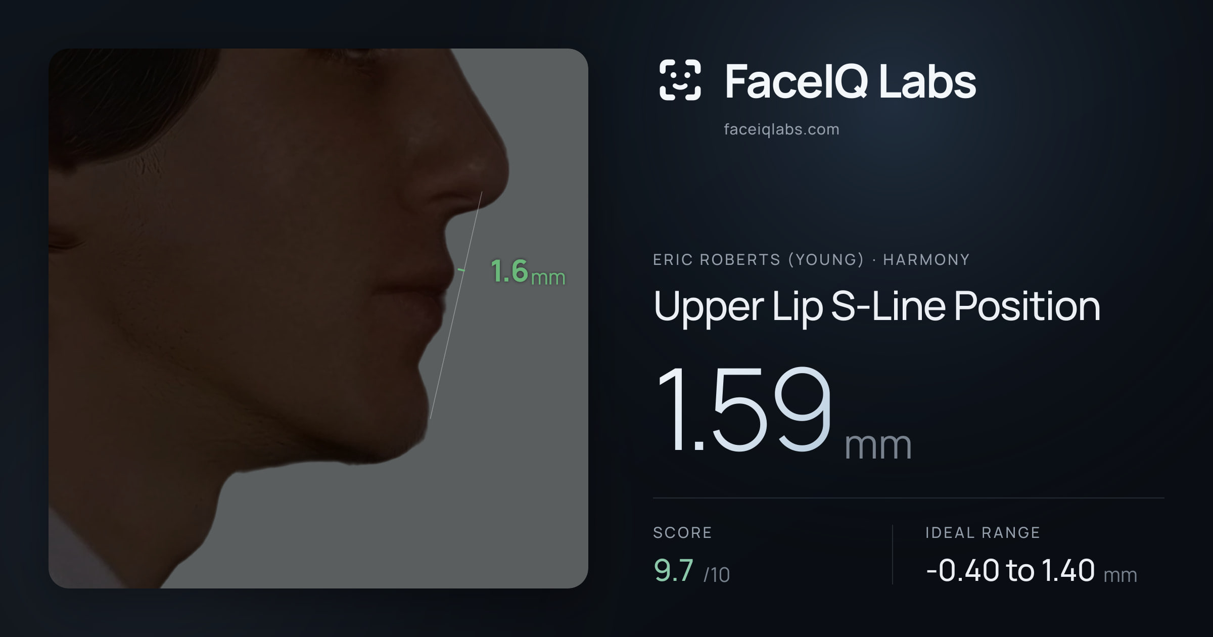 Eric Roberts (Young) Upper Lip S-Line Position: 1.59mm, drawn on the photo