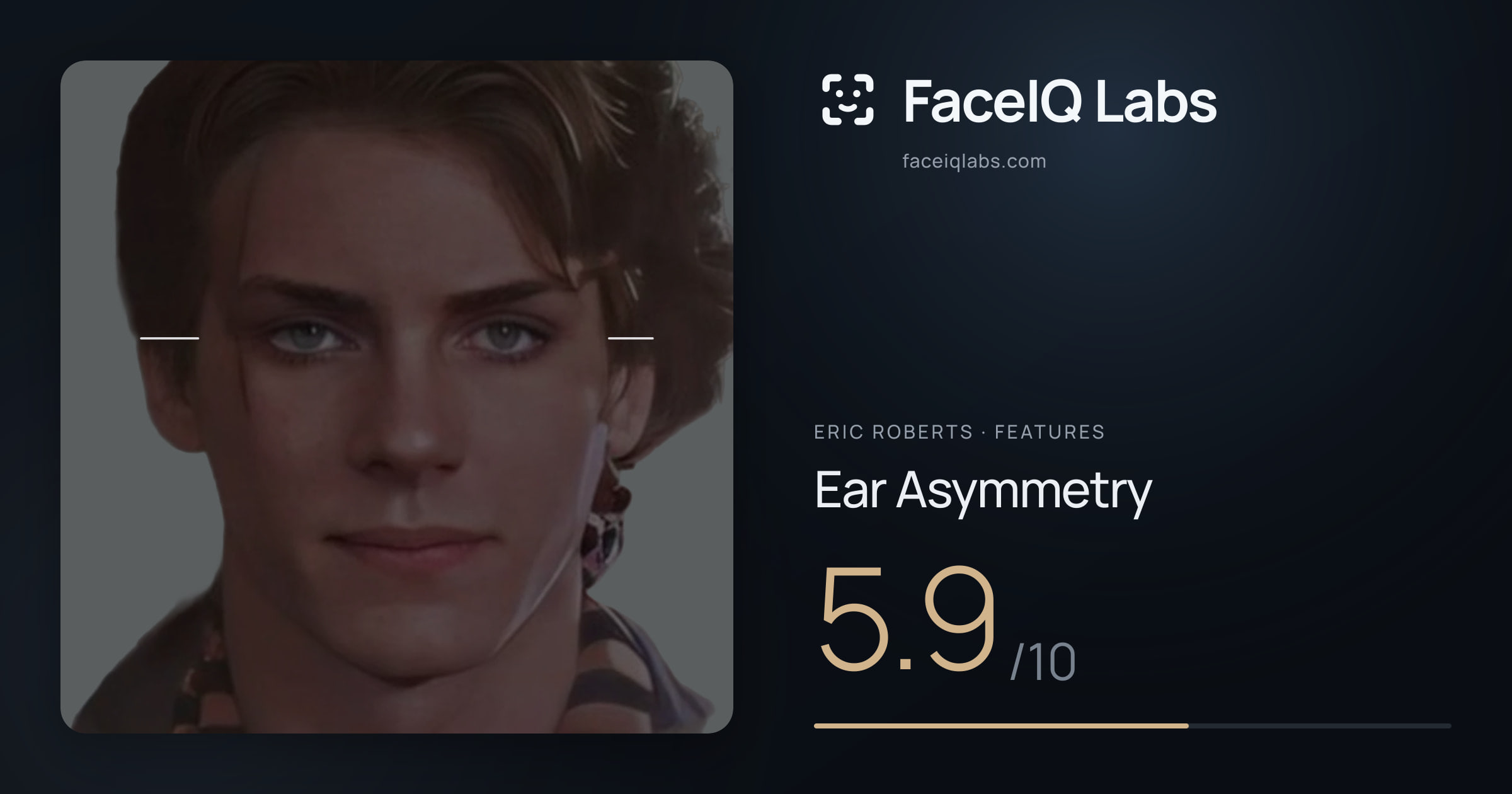 Eric Roberts Ear Asymmetry: 5.9/10, drawn on the photo