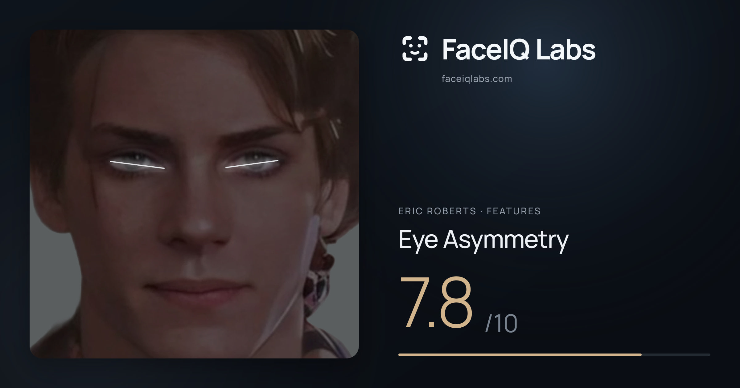 Eric Roberts Eye Asymmetry: 7.8/10, drawn on the photo