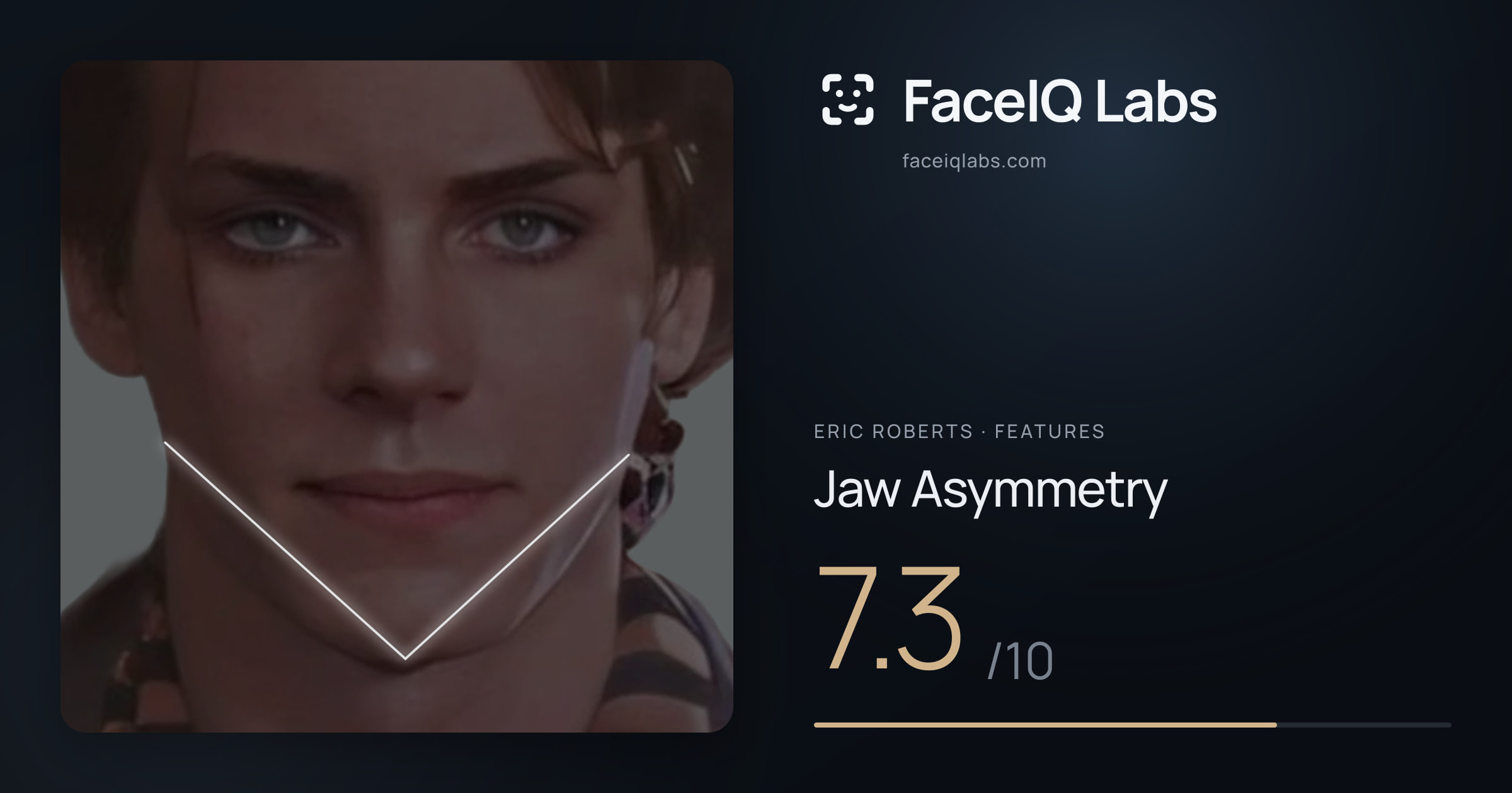 Eric Roberts Jaw Asymmetry: 7.3/10, drawn on the photo