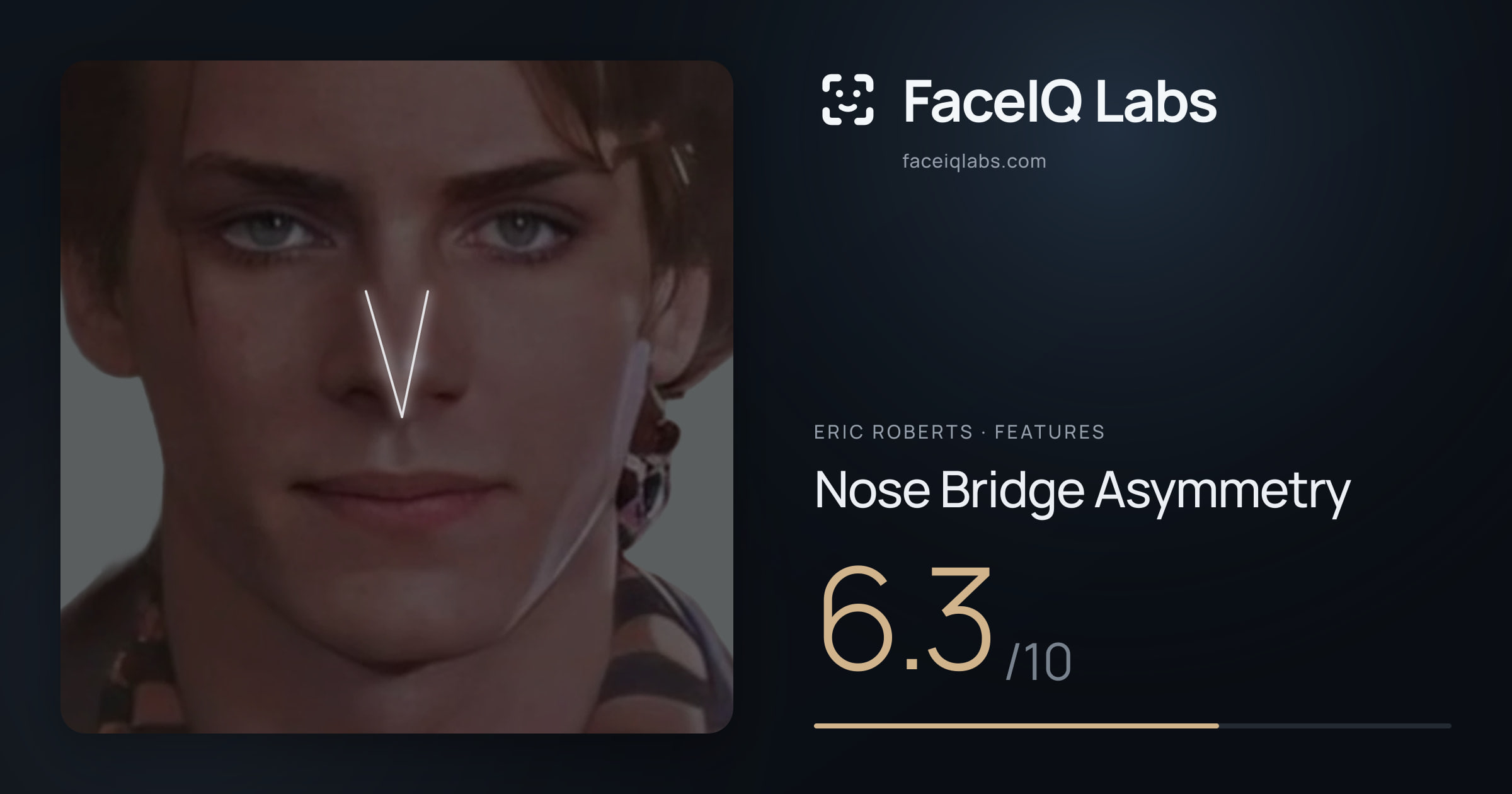 Eric Roberts Nose Bridge Asymmetry: 6.3/10, drawn on the photo