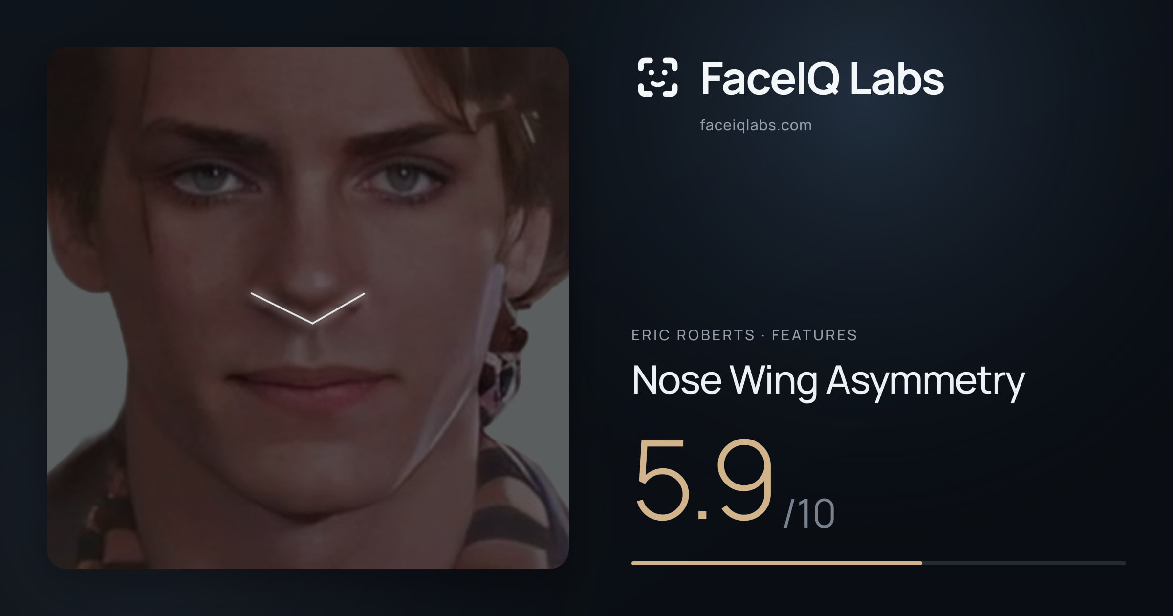 Eric Roberts Nose Wing Asymmetry: 5.9/10, drawn on the photo