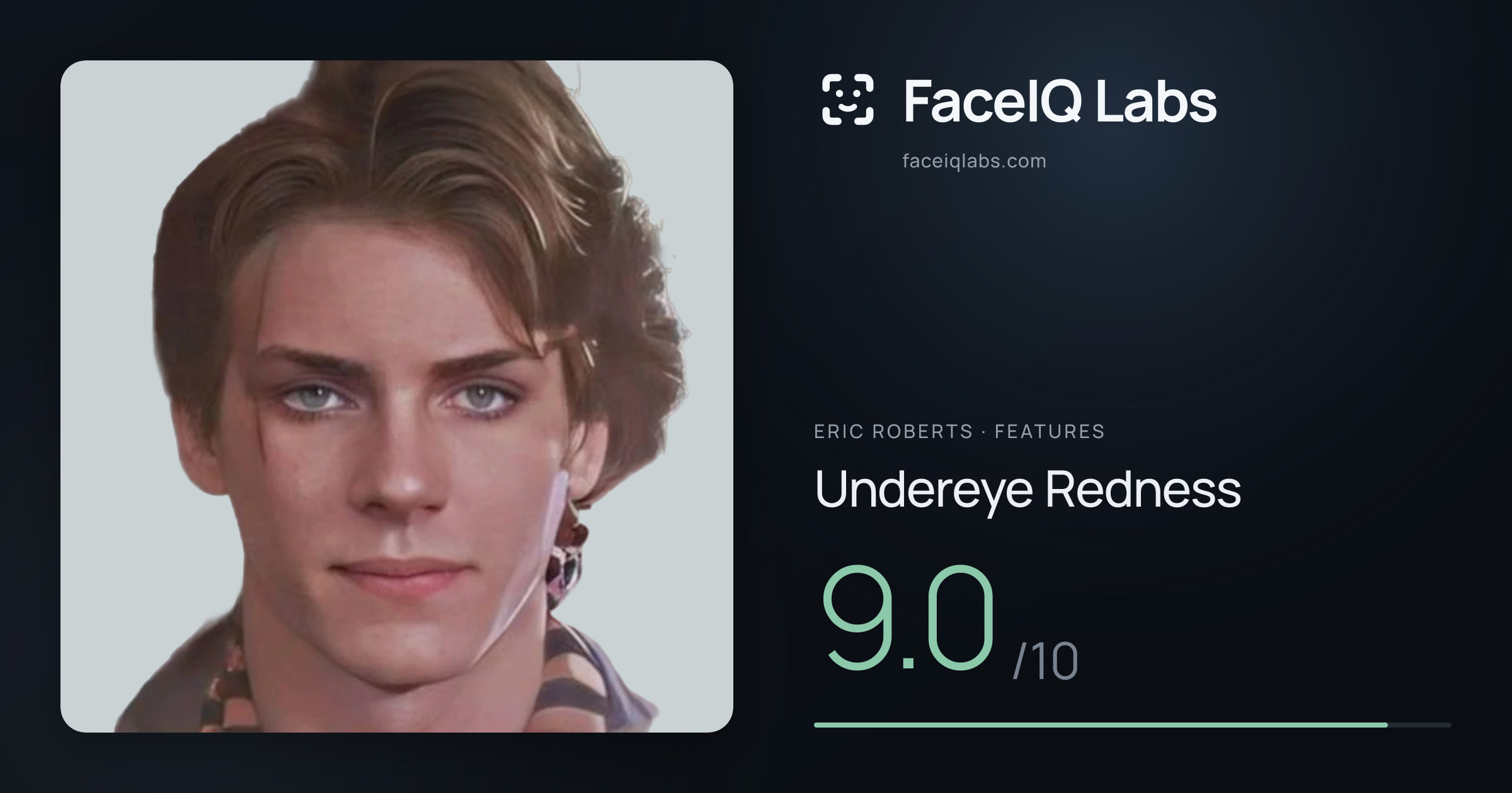 Eric Roberts Undereye Redness: 9.0/10, drawn on the photo