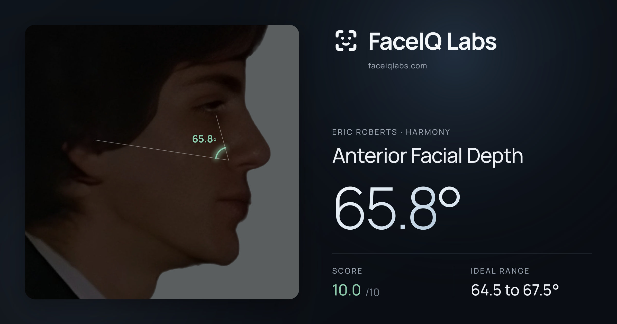Eric Roberts Anterior Facial Depth: 65.8°, drawn on the photo