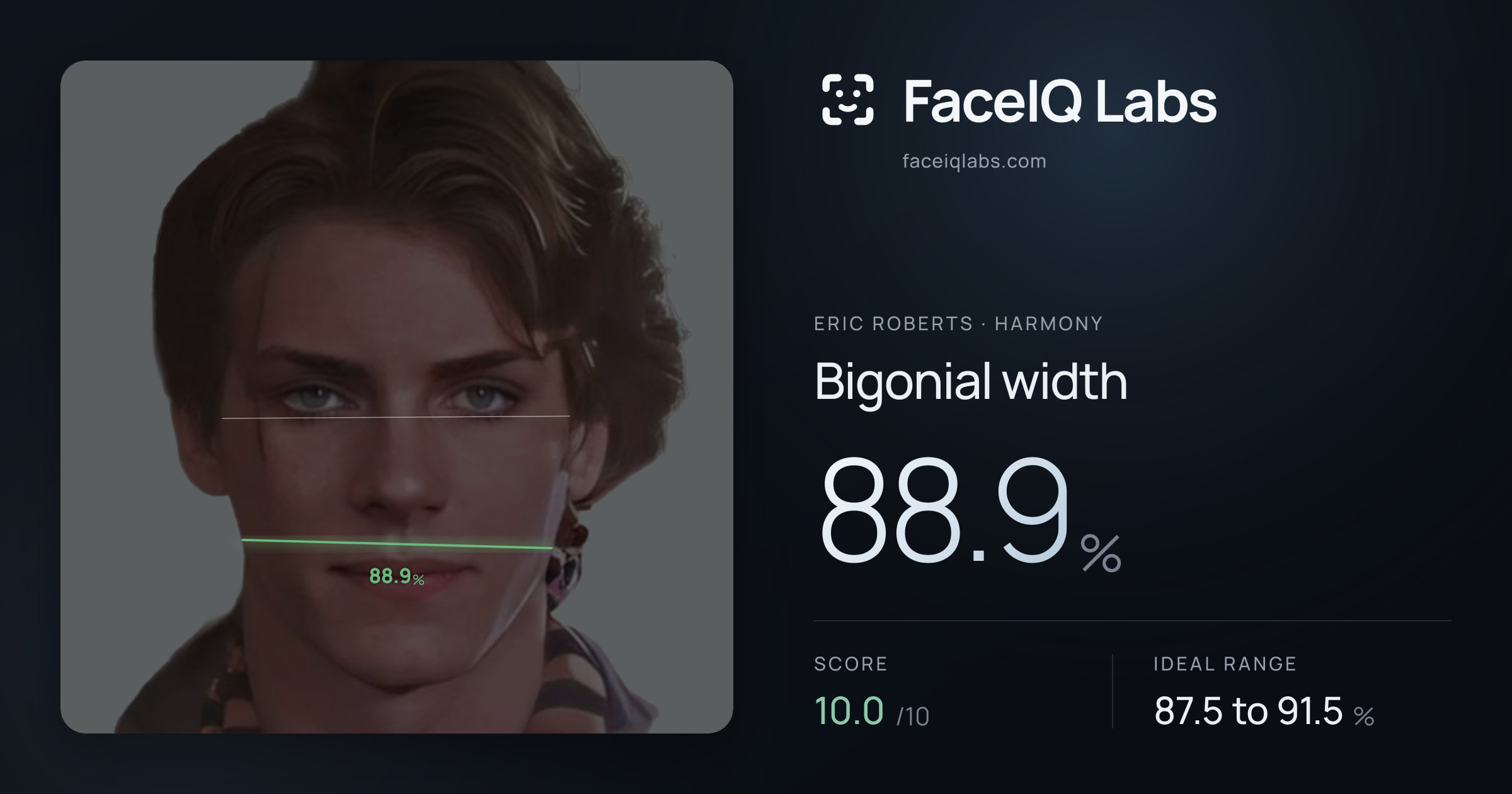 Eric Roberts Bigonial width: 88.9%, drawn on the photo