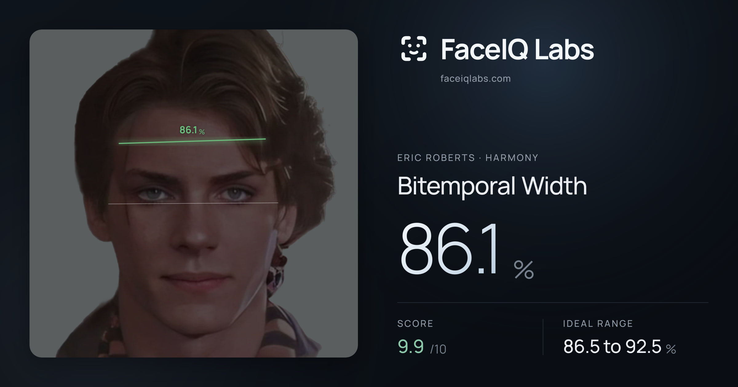 Eric Roberts Bitemporal Width: 86.1%, drawn on the photo