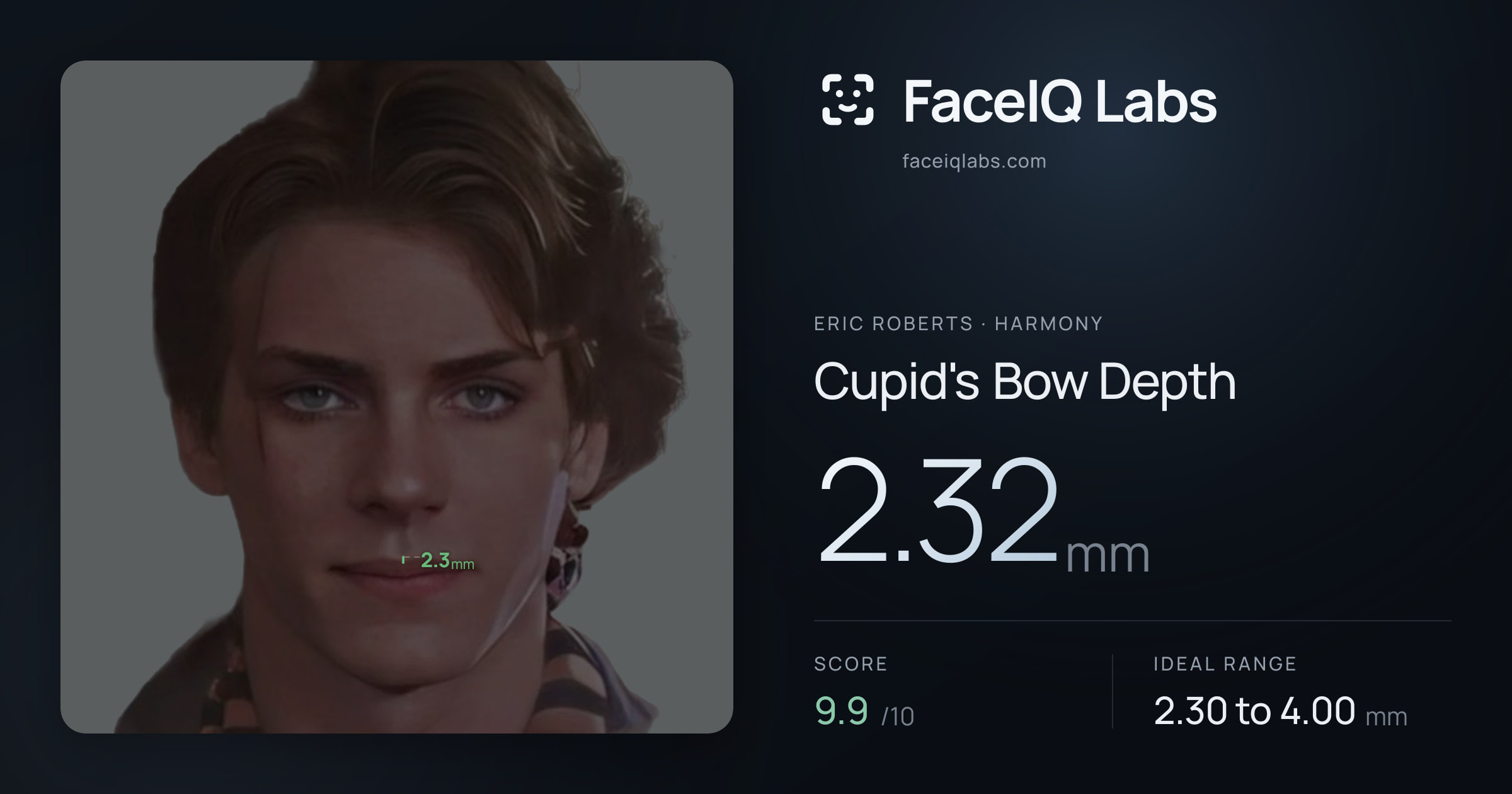 Eric Roberts Cupid's Bow Depth: 2.32mm, drawn on the photo
