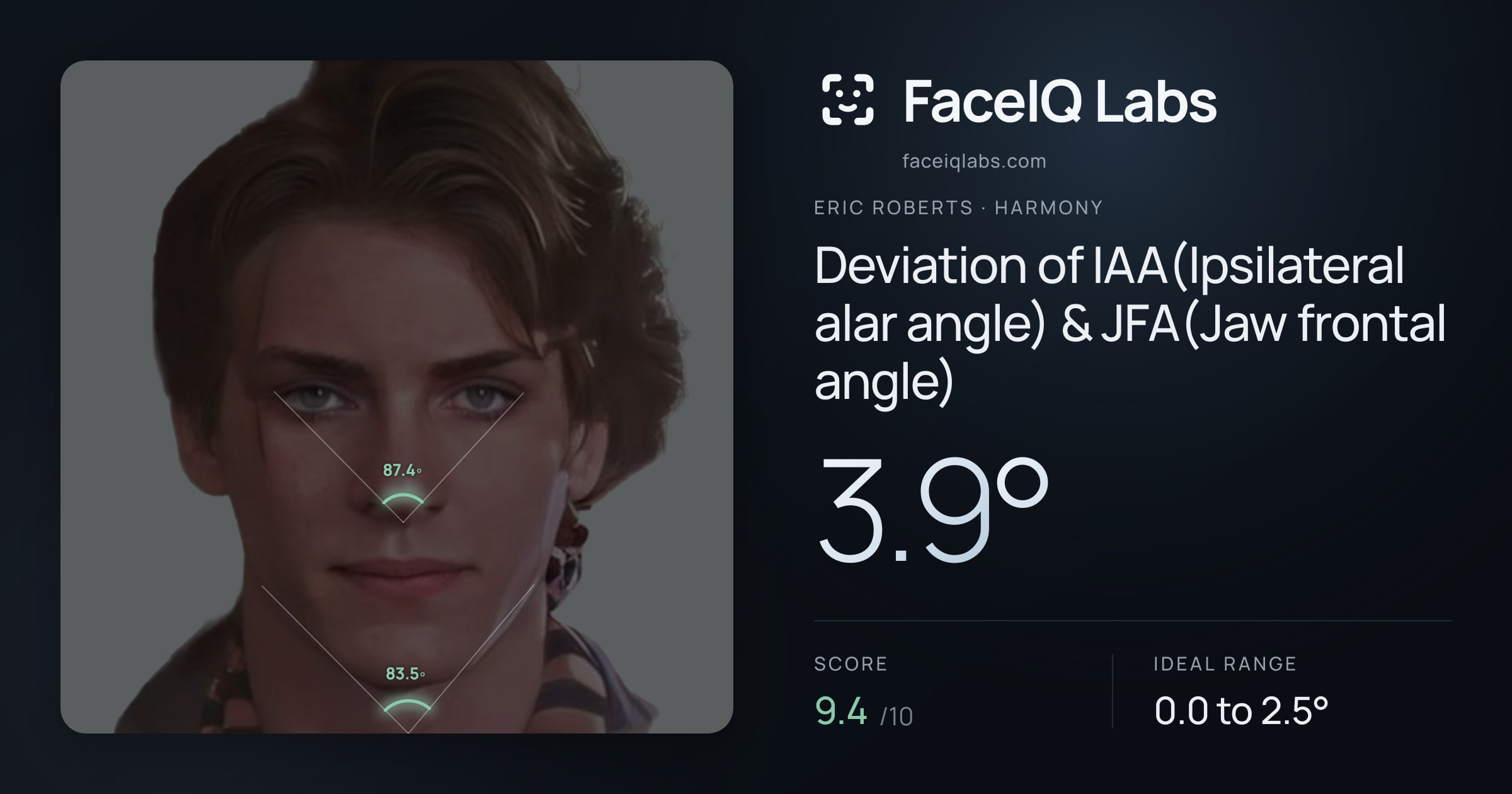 Eric Roberts Deviation of IAA(Ipsilateral alar angle) & JFA(Jaw frontal angle): 3.9°, drawn on the photo
