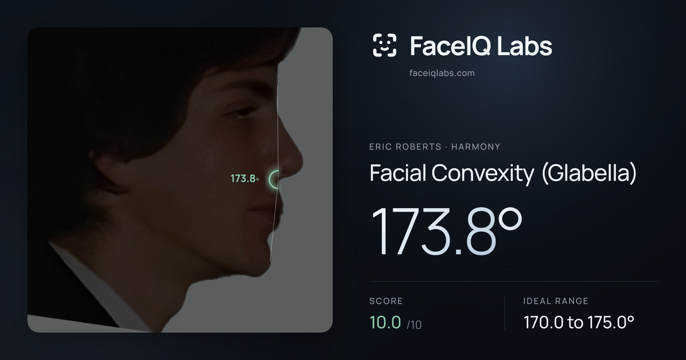 Eric Roberts Facial Convexity (Glabella): 173.8°, drawn on the photo