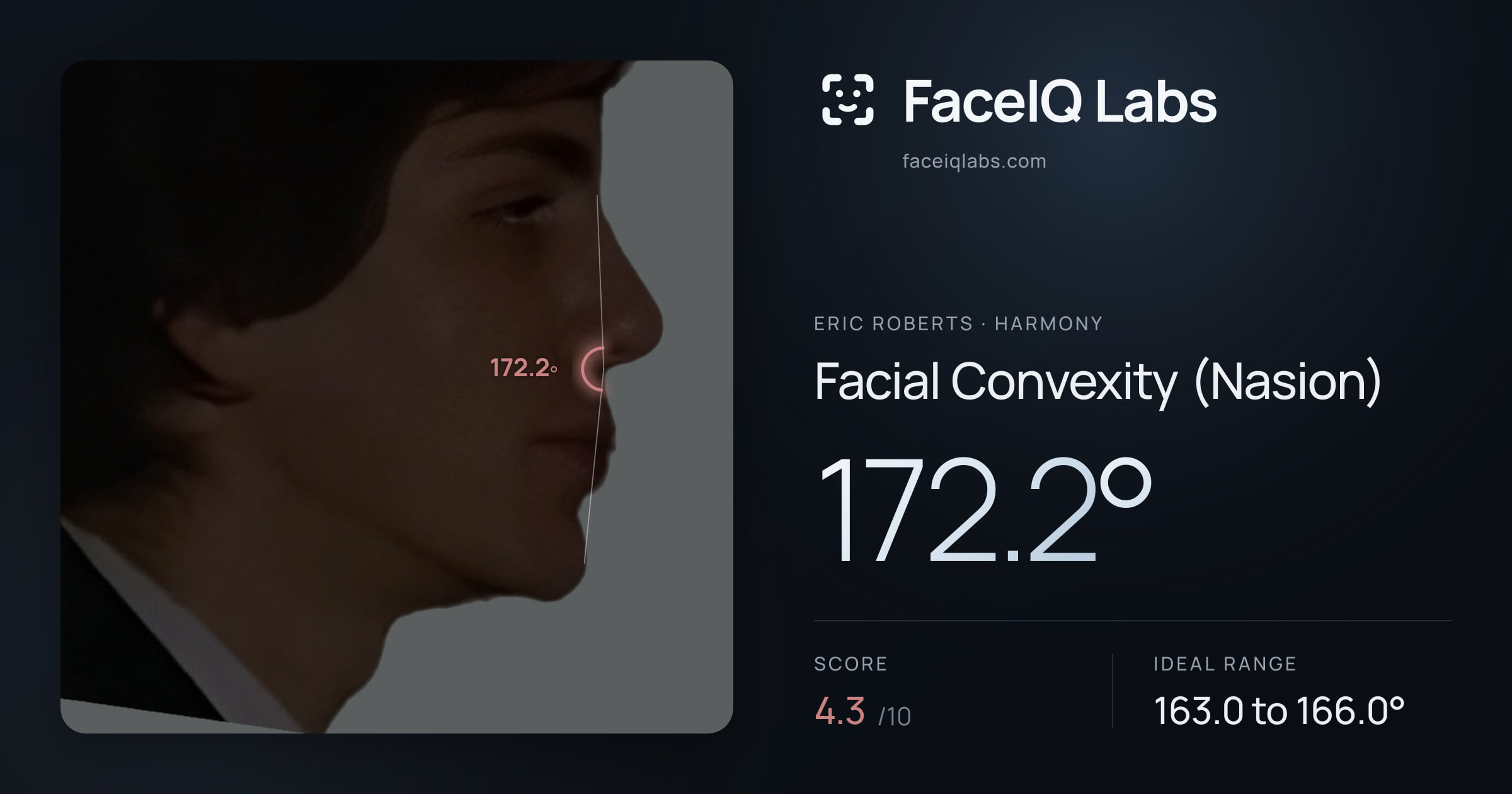 Eric Roberts Facial Convexity (Nasion): 172.2°, drawn on the photo
