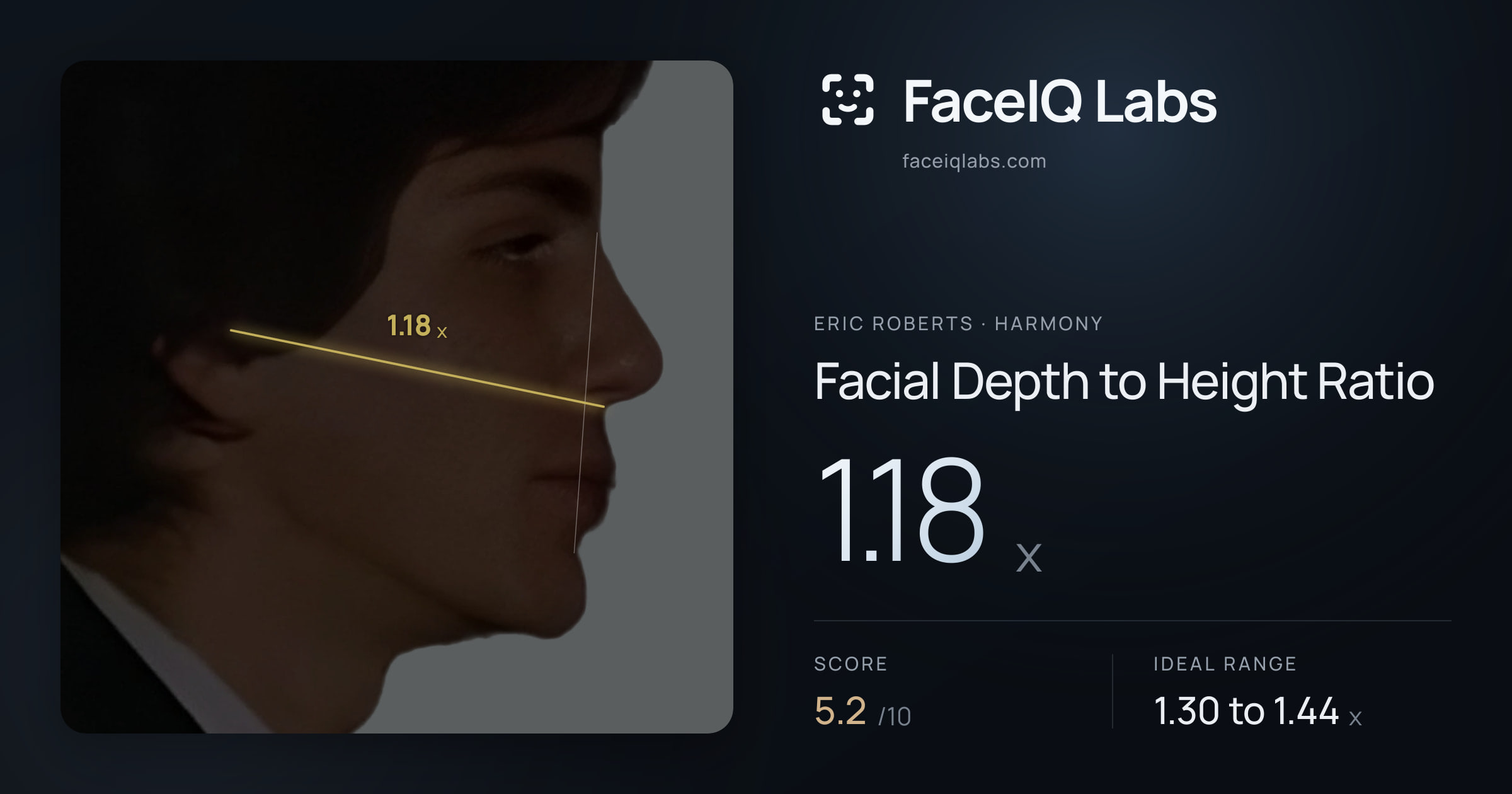 Eric Roberts Facial Depth to Height Ratio: 1.18x, drawn on the photo