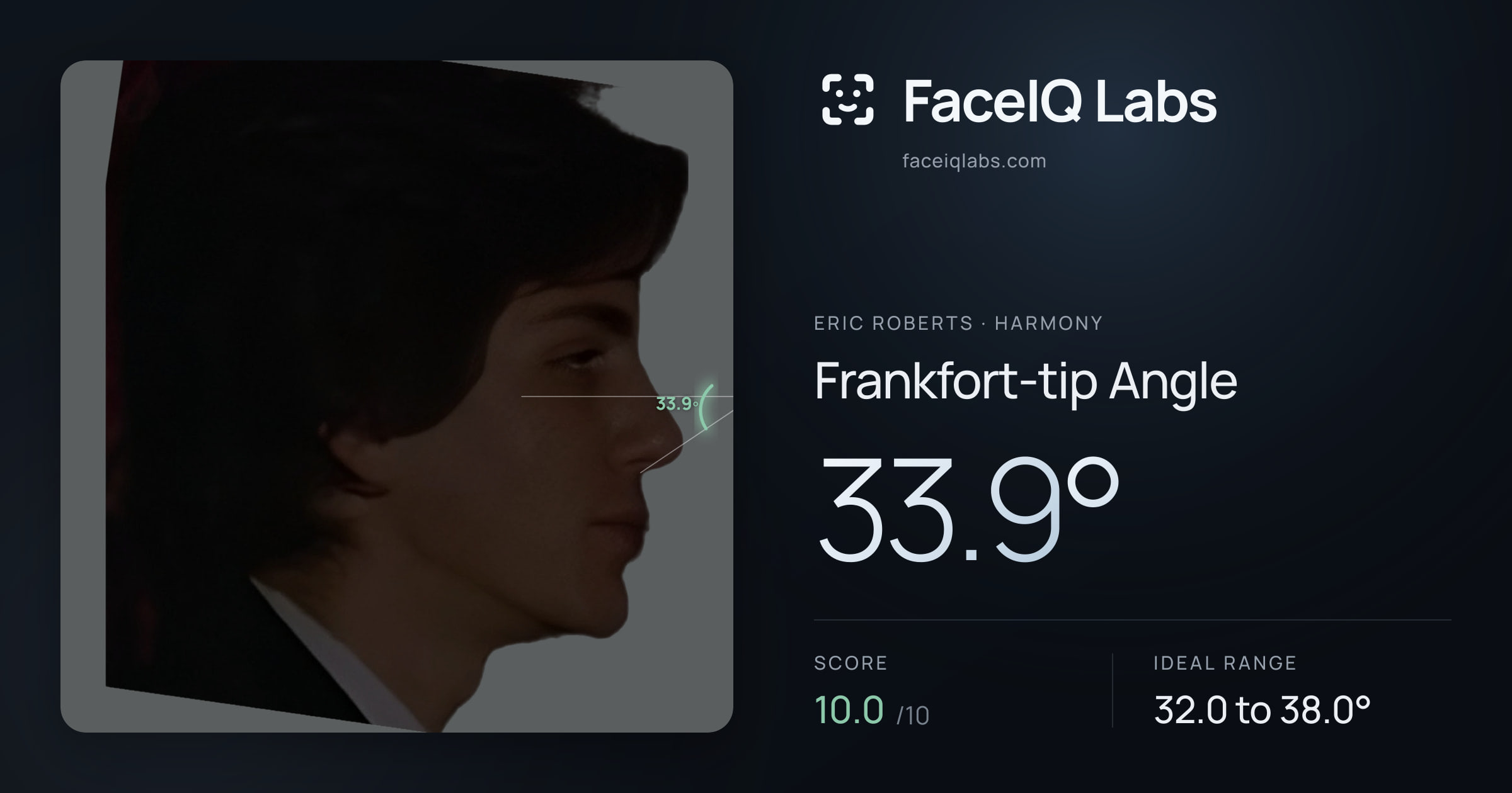 Eric Roberts Frankfort-tip Angle: 33.9°, drawn on the photo