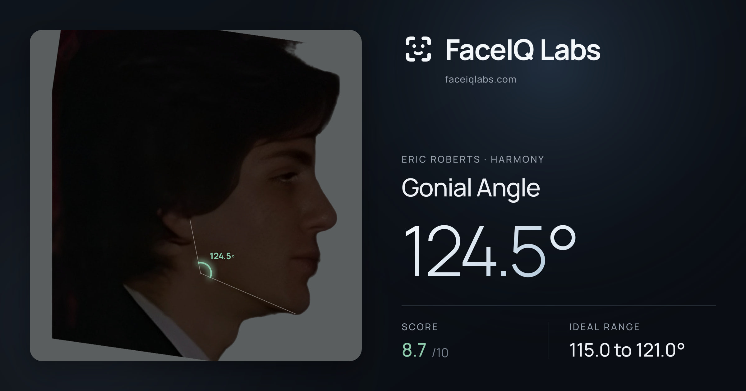 Eric Roberts Gonial Angle: 124.5°, drawn on the photo
